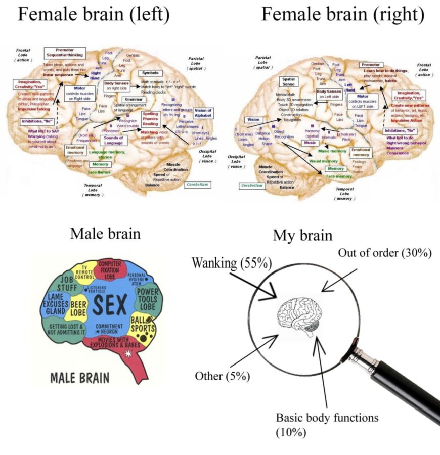 Brain comparison