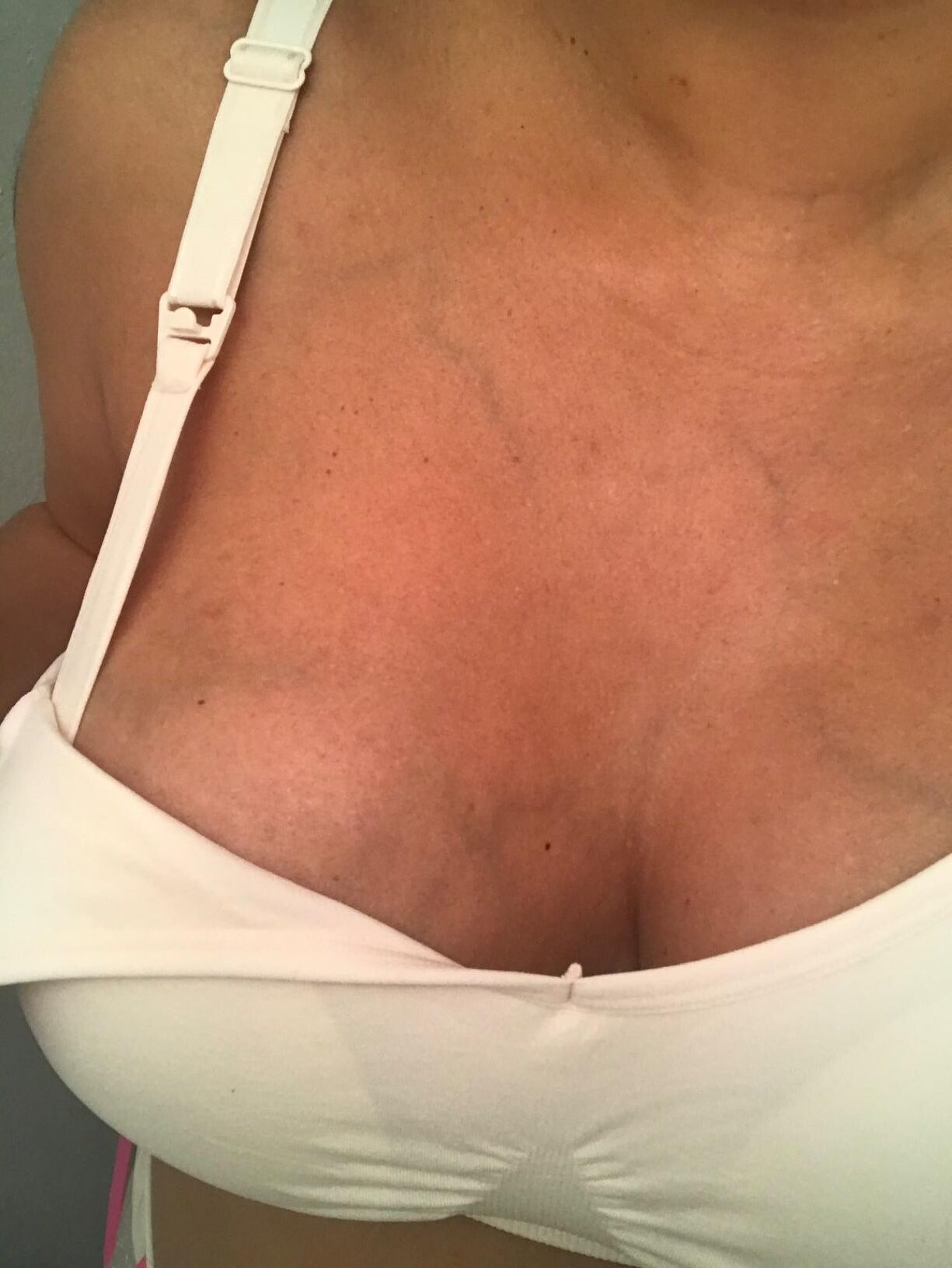 moms tits are engorged with milk and swollen