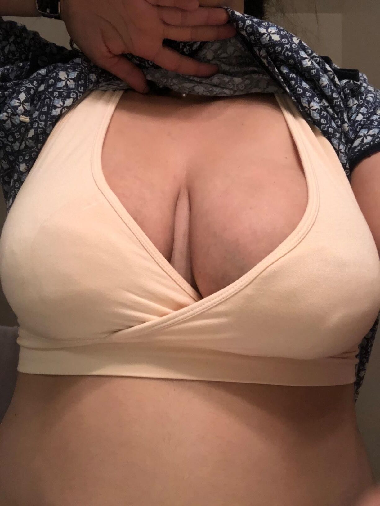 moms tits are engorged with milk and swollen