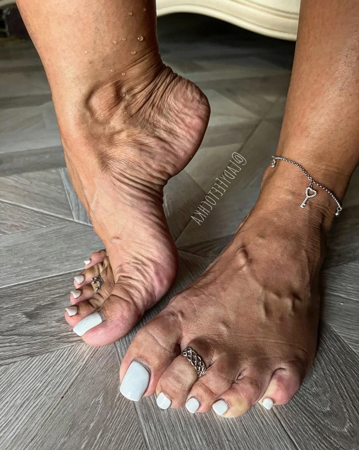 uñas de los pies muy largas