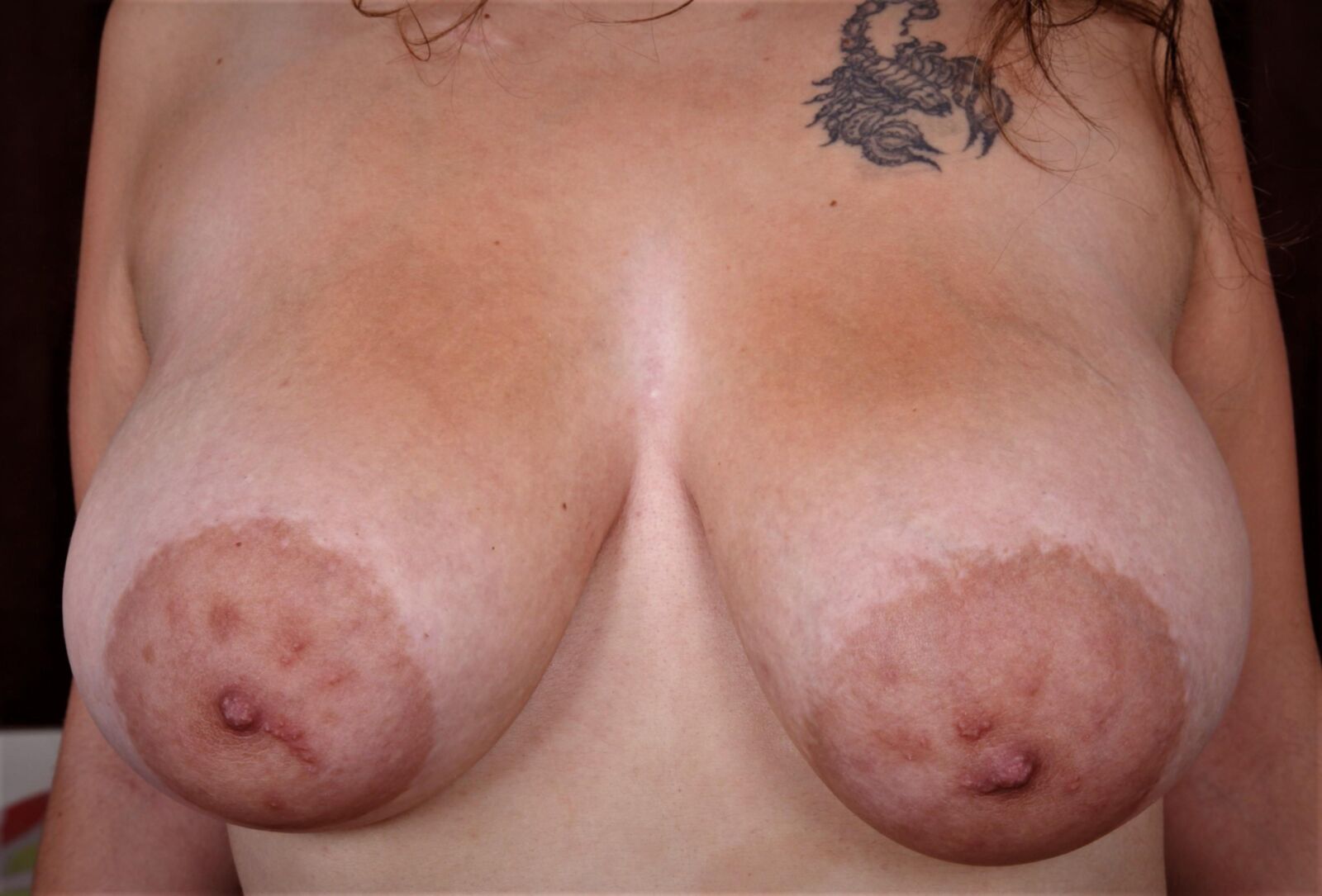 AREOLAS CON TEXTURA 2