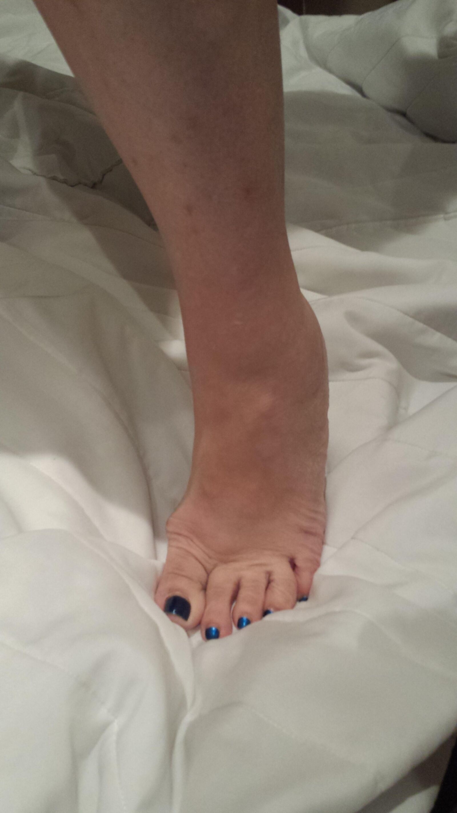 GF Feet