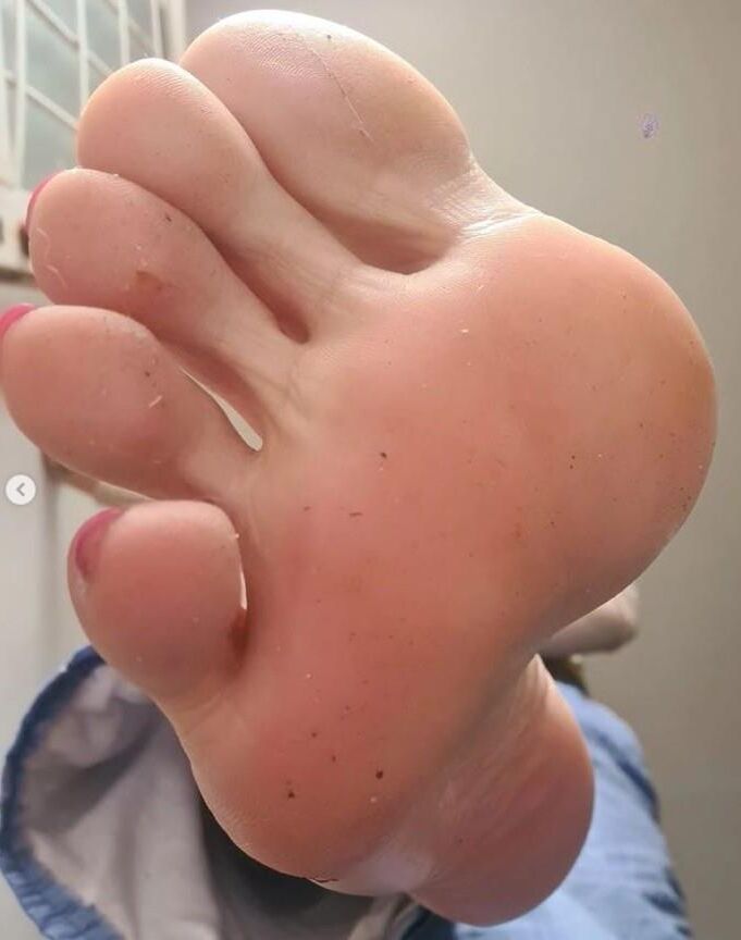 Hot Feet and Soles 