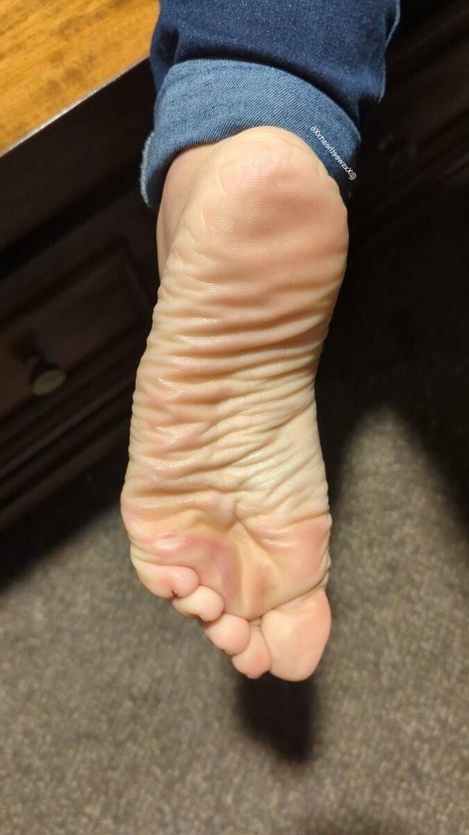 Hot Feet and Soles 