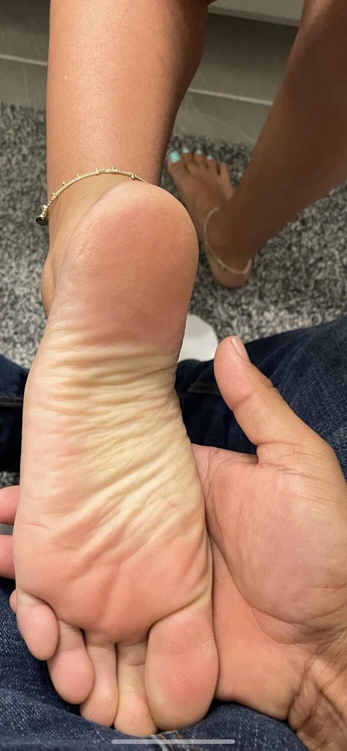 Hot Feet and Soles 