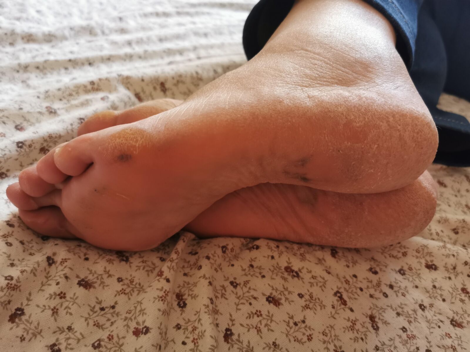 Les pieds de ma mère se sec