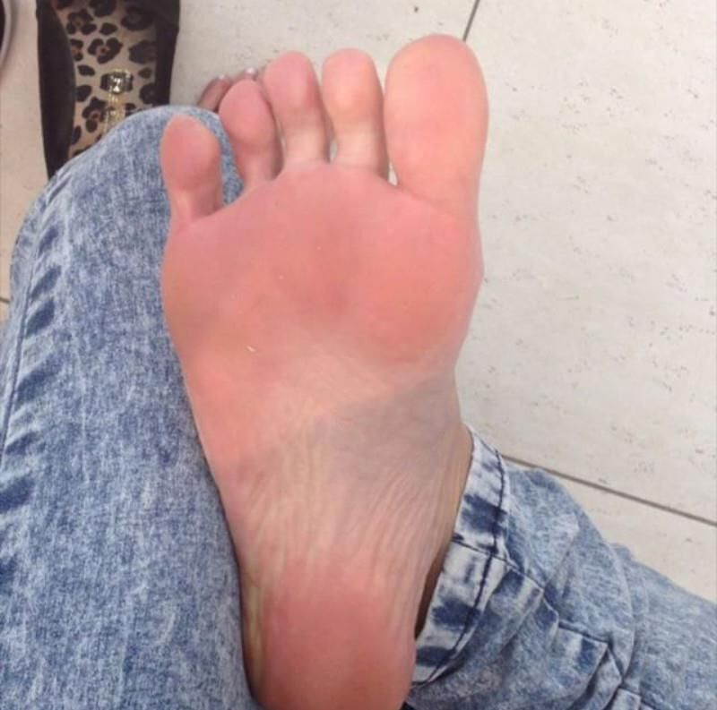 Une collection d'années de pieds Ig