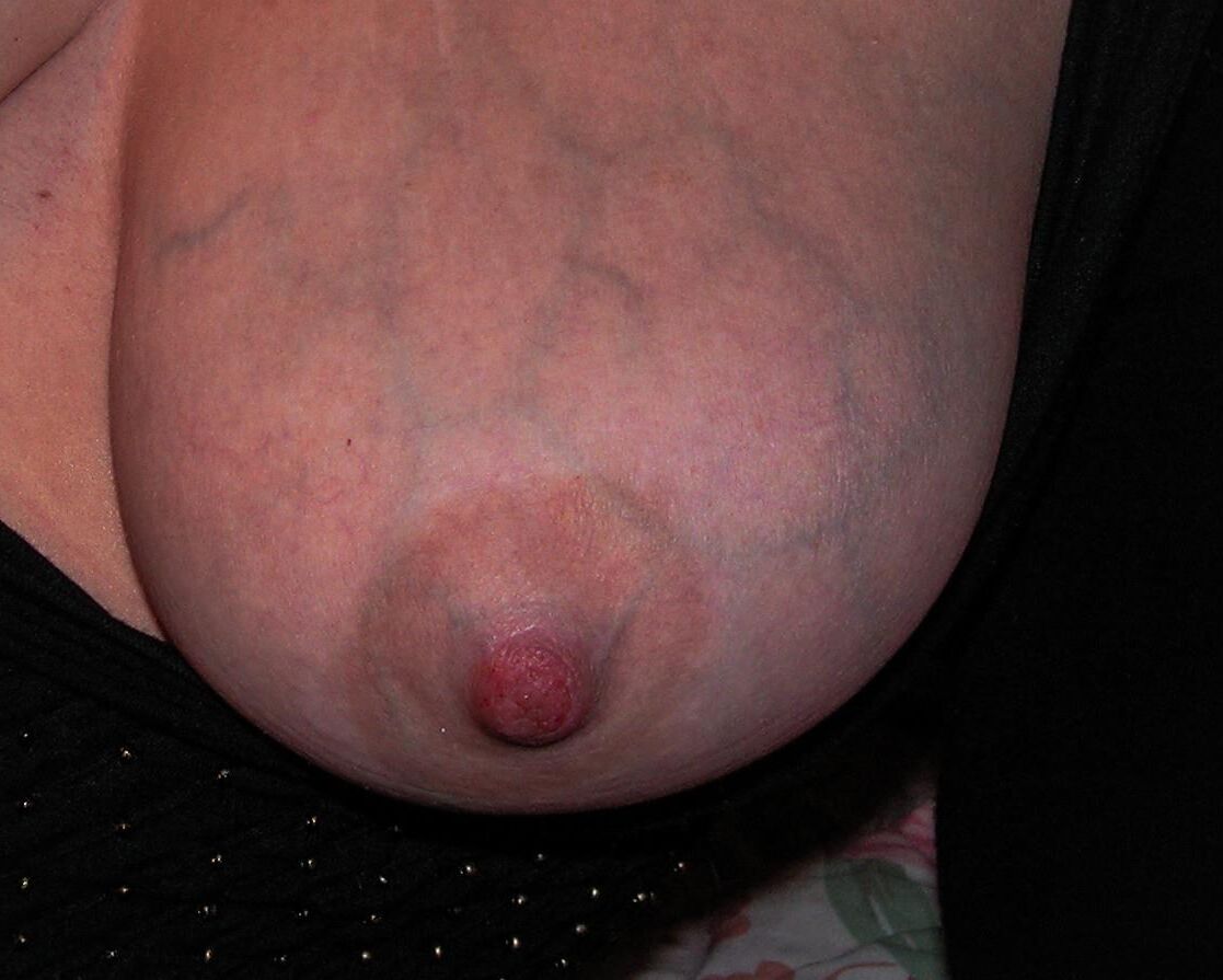 静脈と私のおっぱい。
