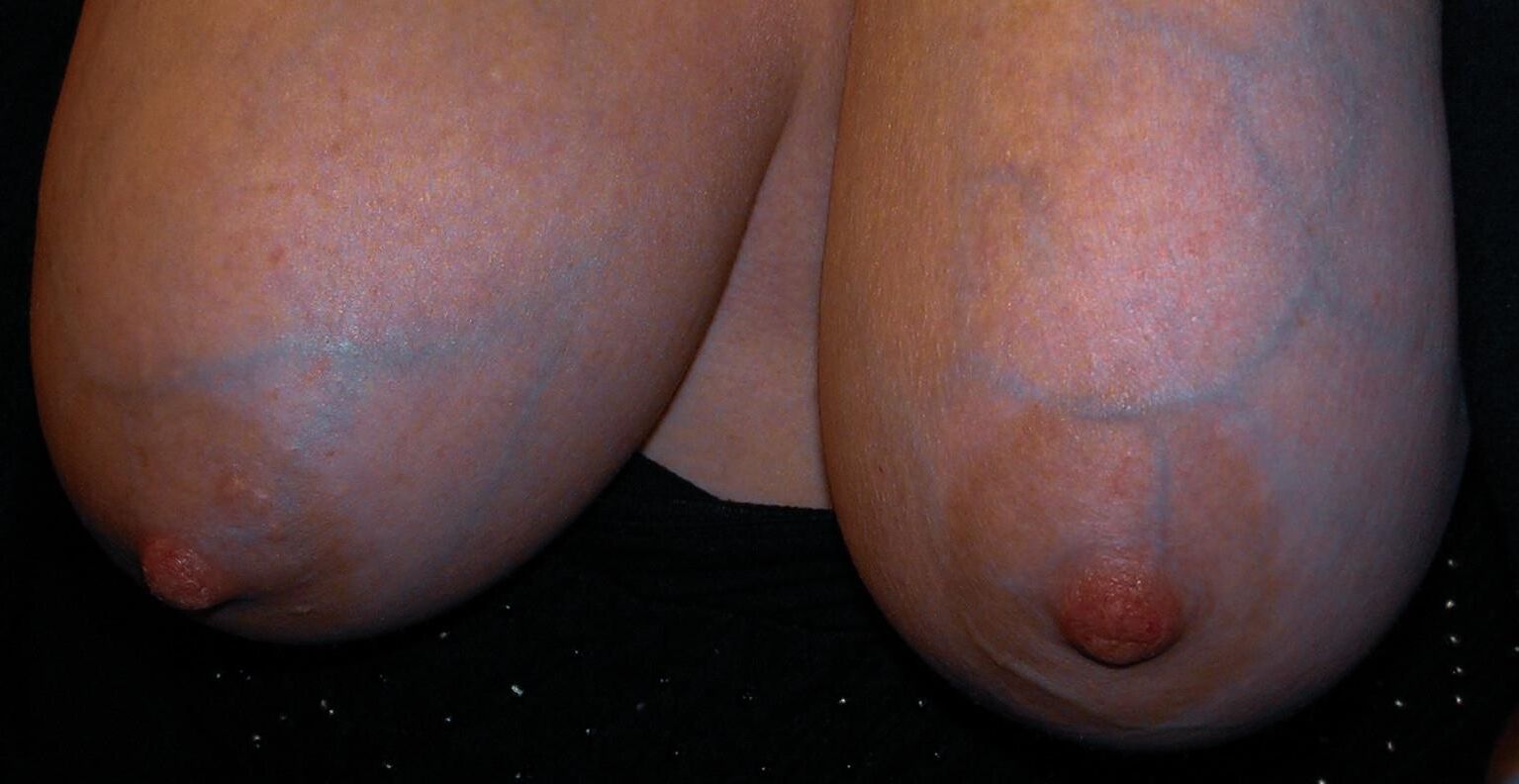 静脈と私のおっぱい。