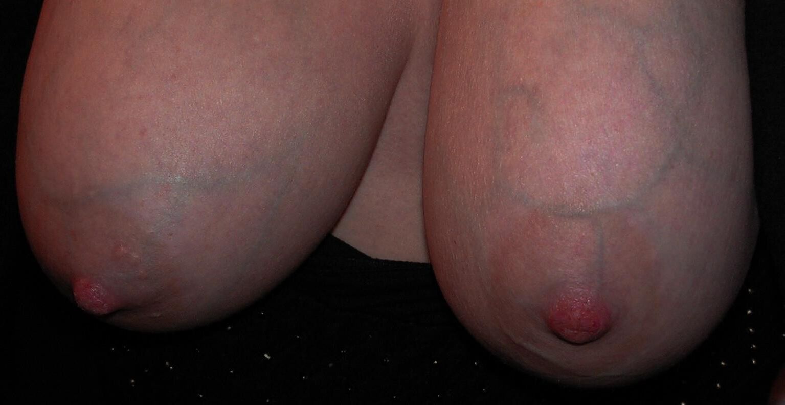 静脈と私のおっぱい。