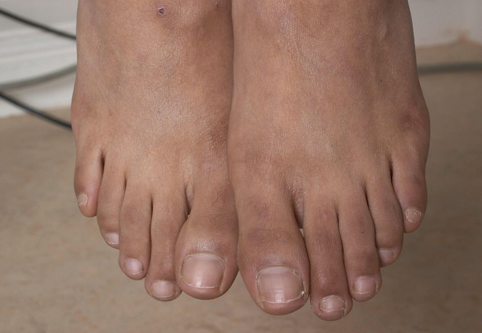 toes&piggies detailed close up 