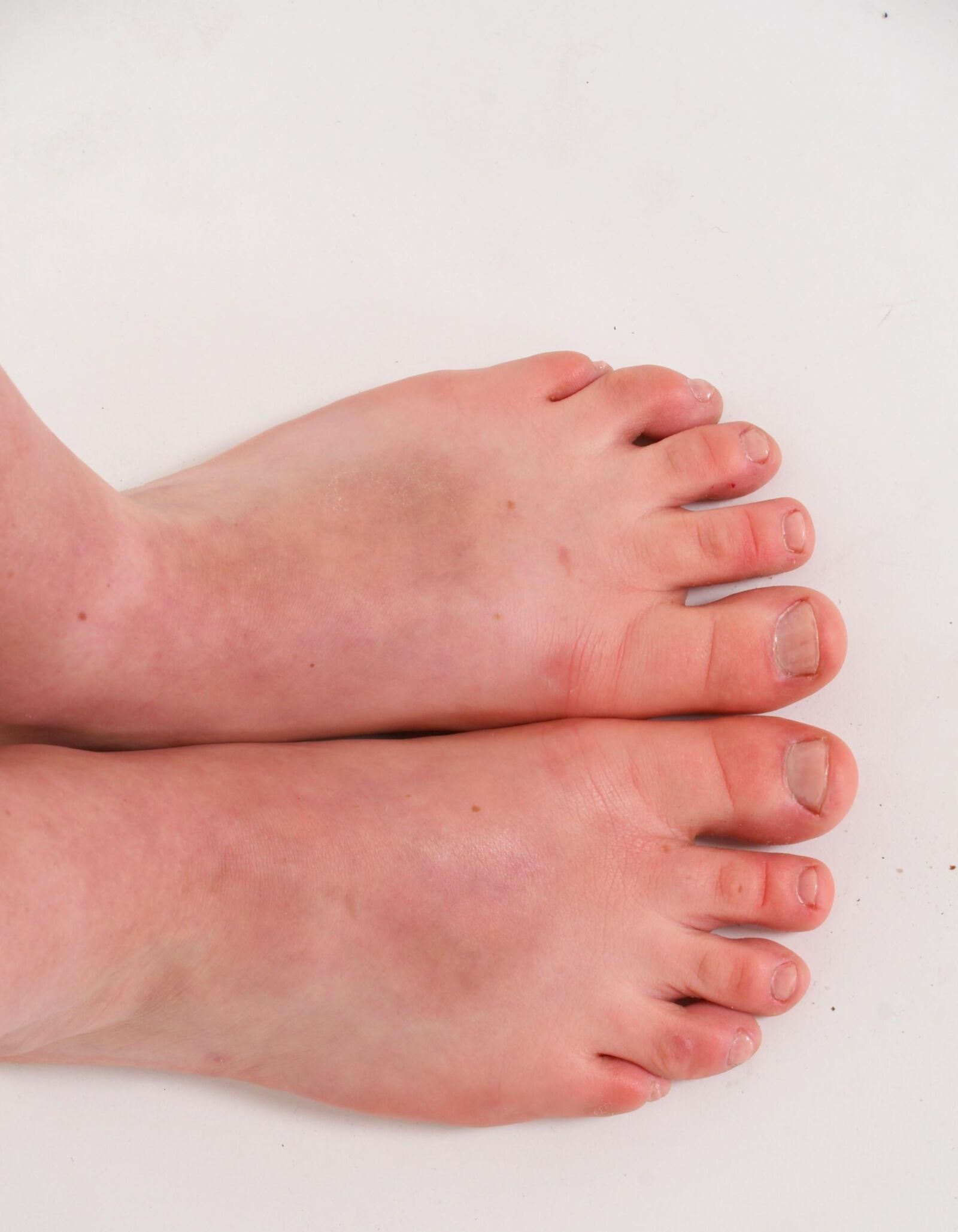 toes&piggies detailed close up 