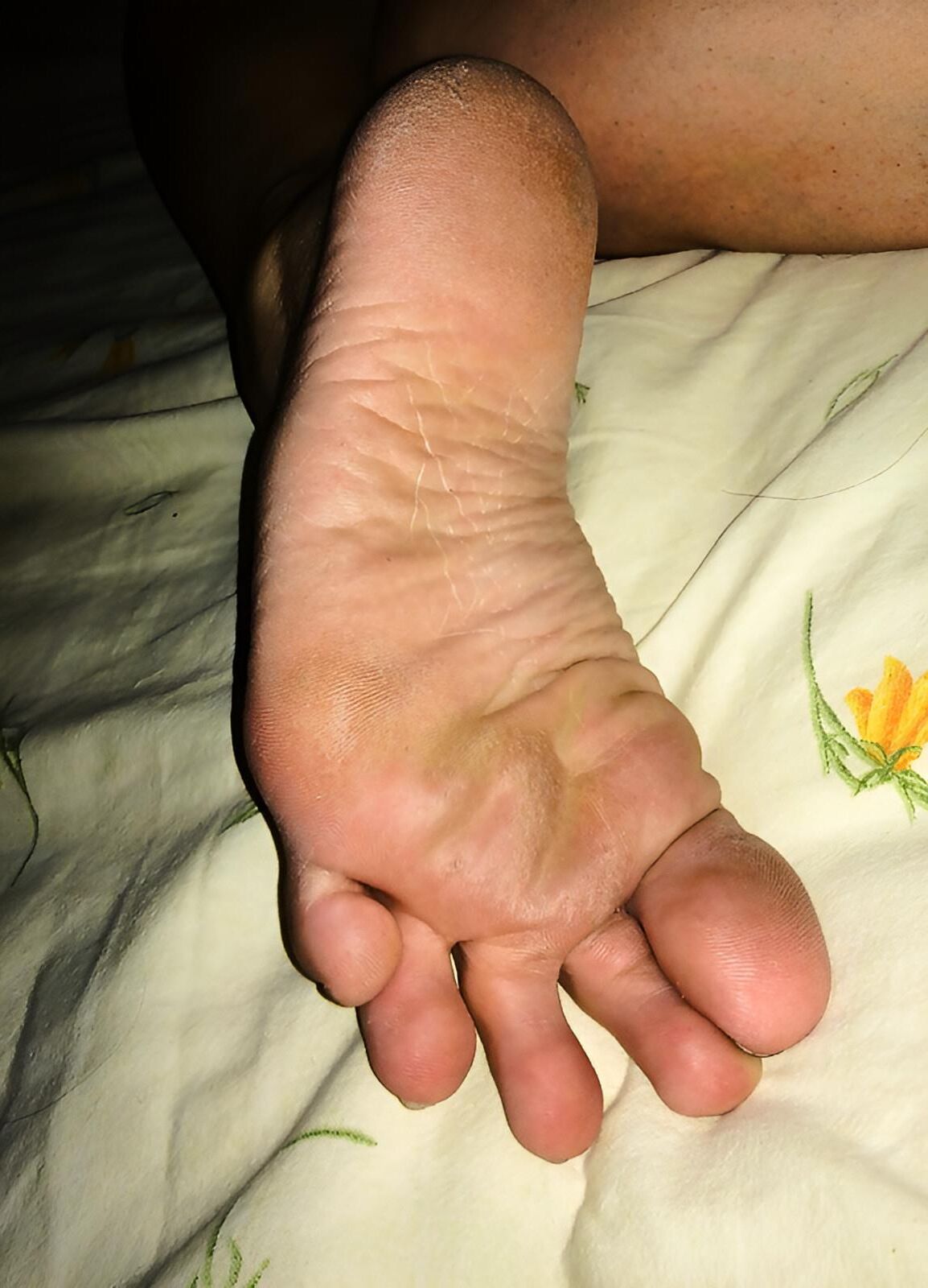 Pieds chauds et semelles