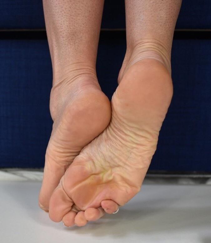 Pieds chauds et semelles