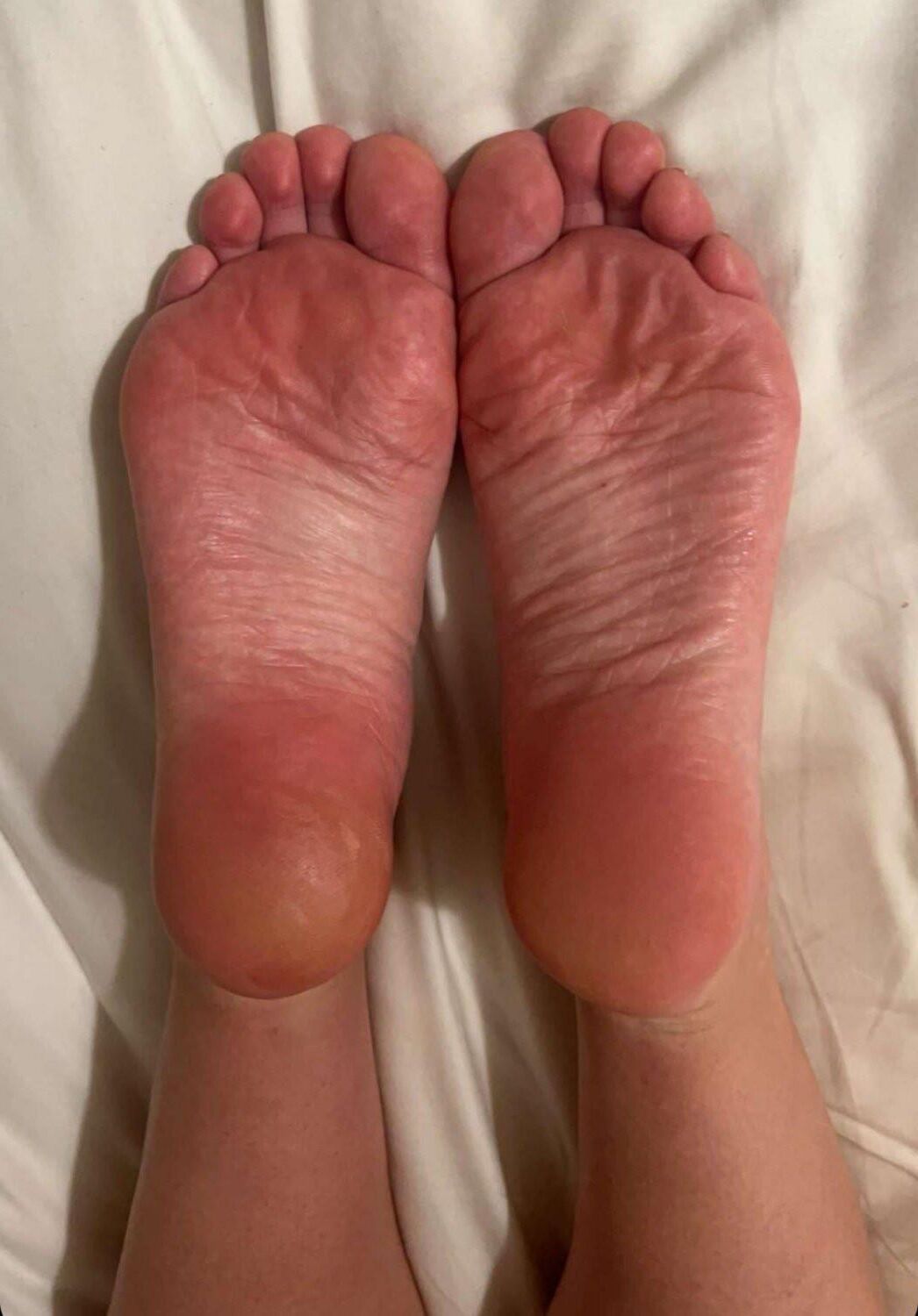 Pieds chauds et semelles