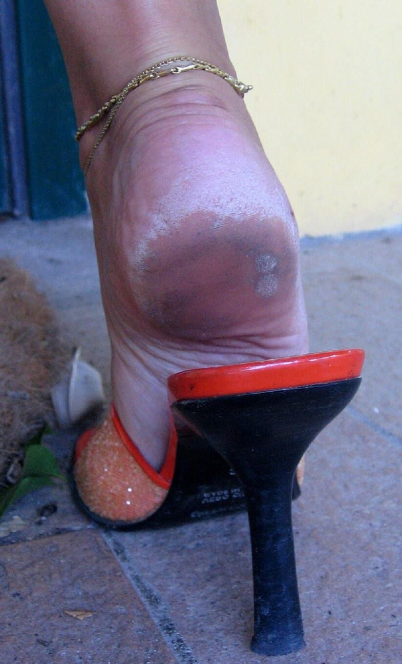 suelas descalzos y tacones de olor a queso de pie de pie