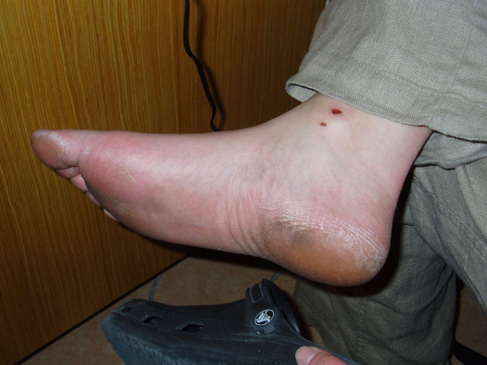 suelas descalzos y tacones de olor a queso de pie de pie