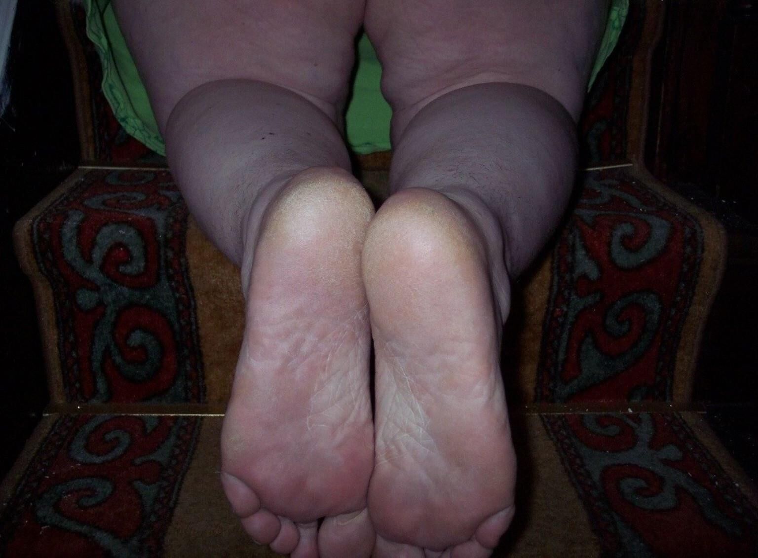 suelas descalzos y tacones de olor a queso de pie de pie