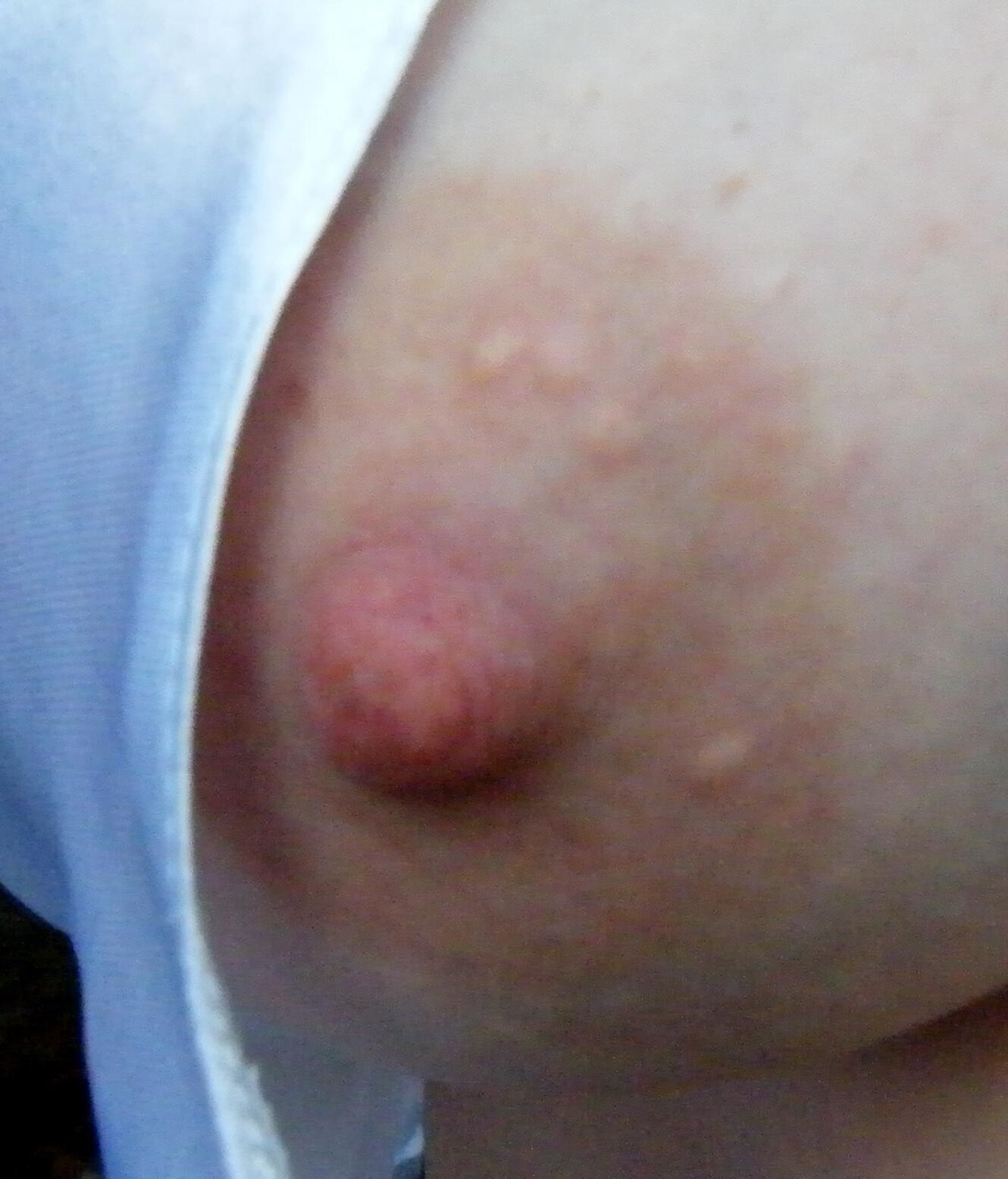 あなたをfrする乳首