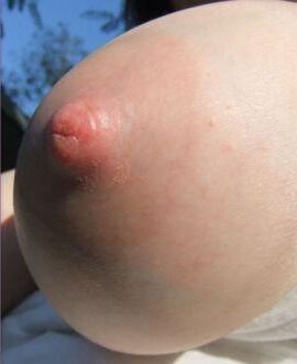 あなたをfrする乳首。