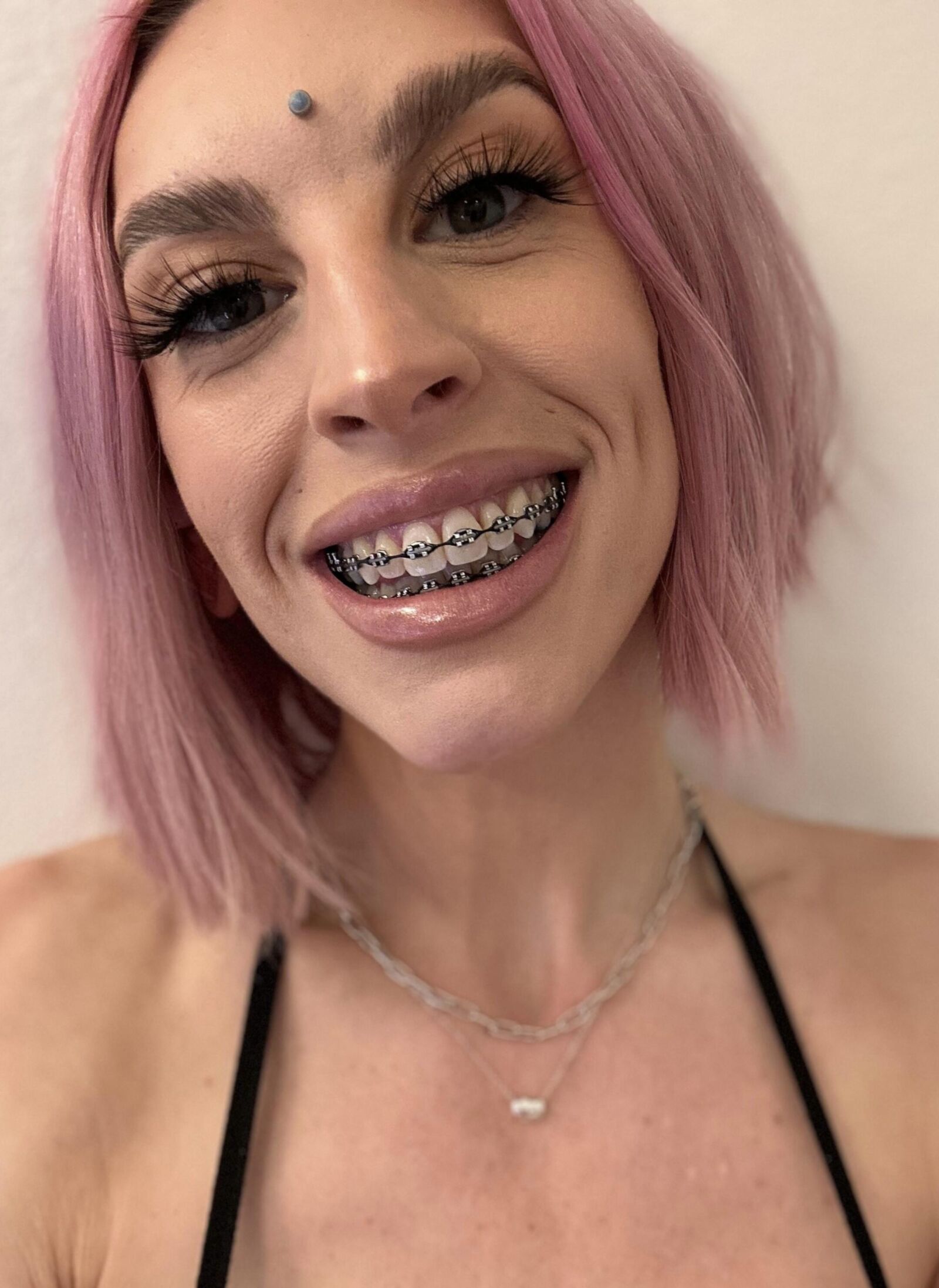 Brace Face Slut