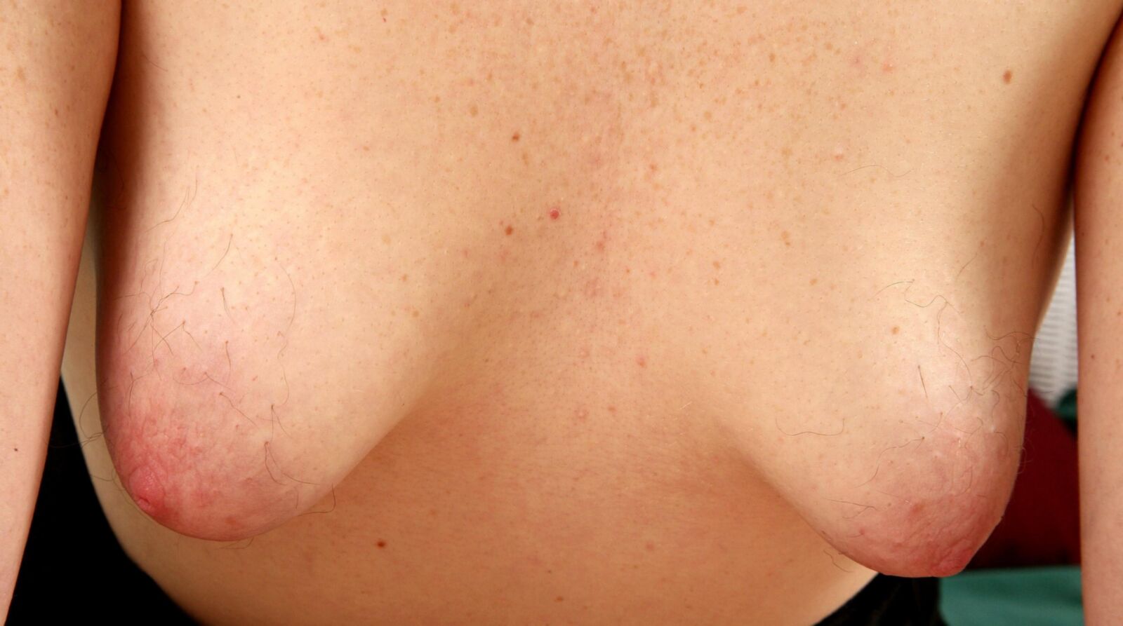 Cabello alrededor de sus pezones