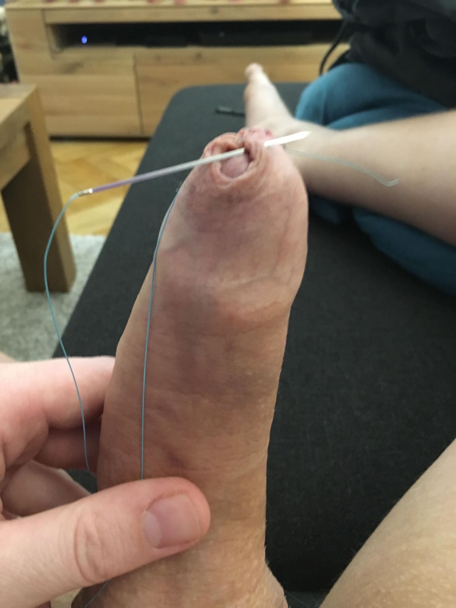Foreskin games (sew foreskin)