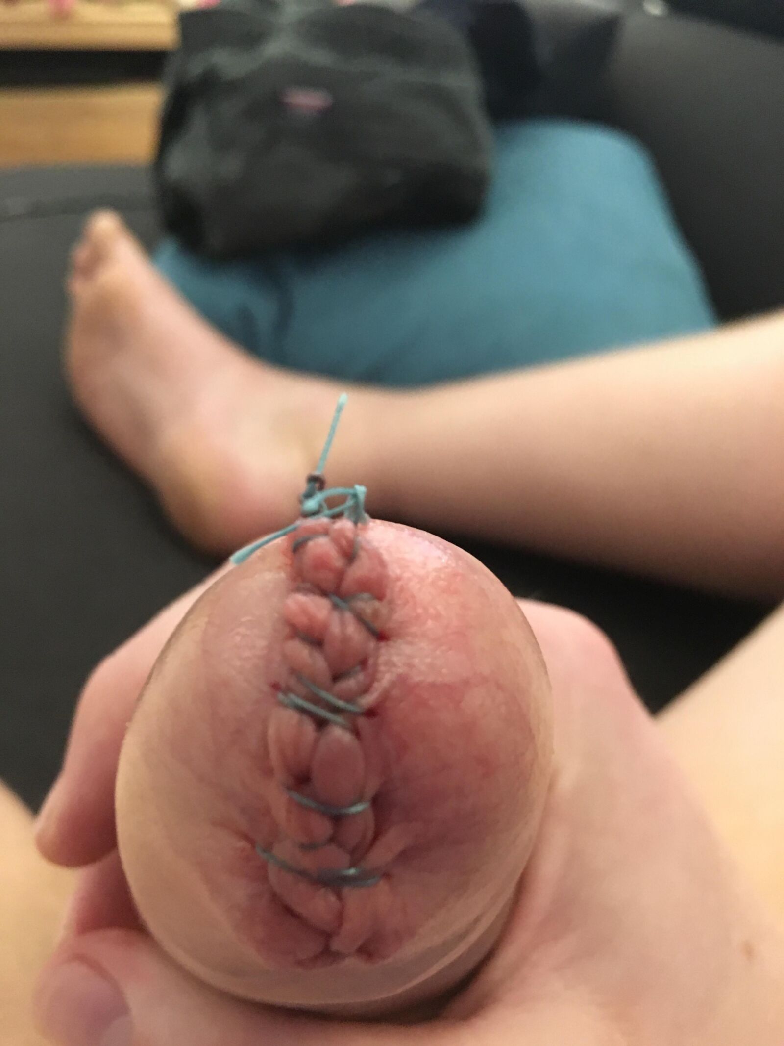 Foreskin games (sew foreskin)