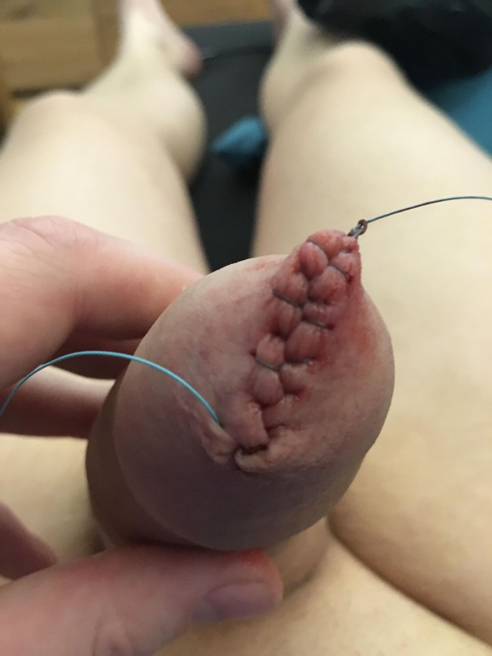 Foreskin games (sew foreskin)