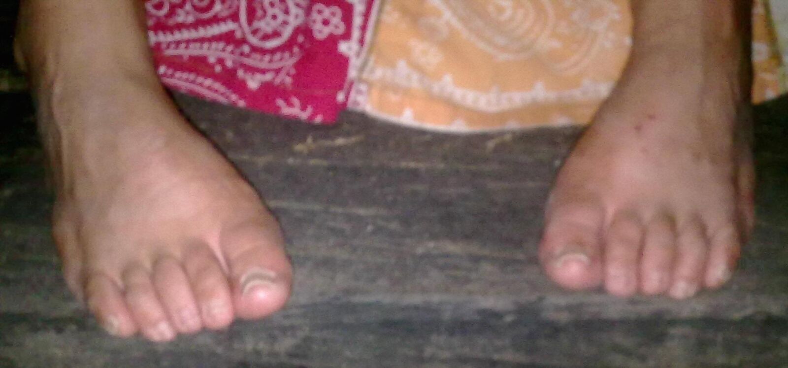 LATIN MOM'S ROUGH FEET