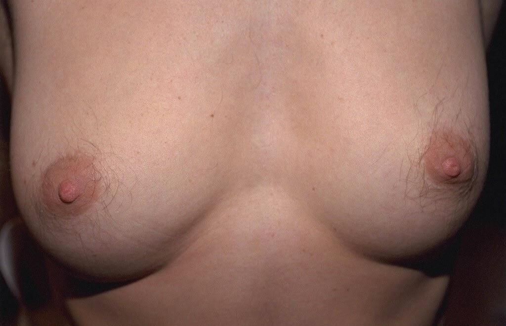 Cabello alrededor de sus pezones