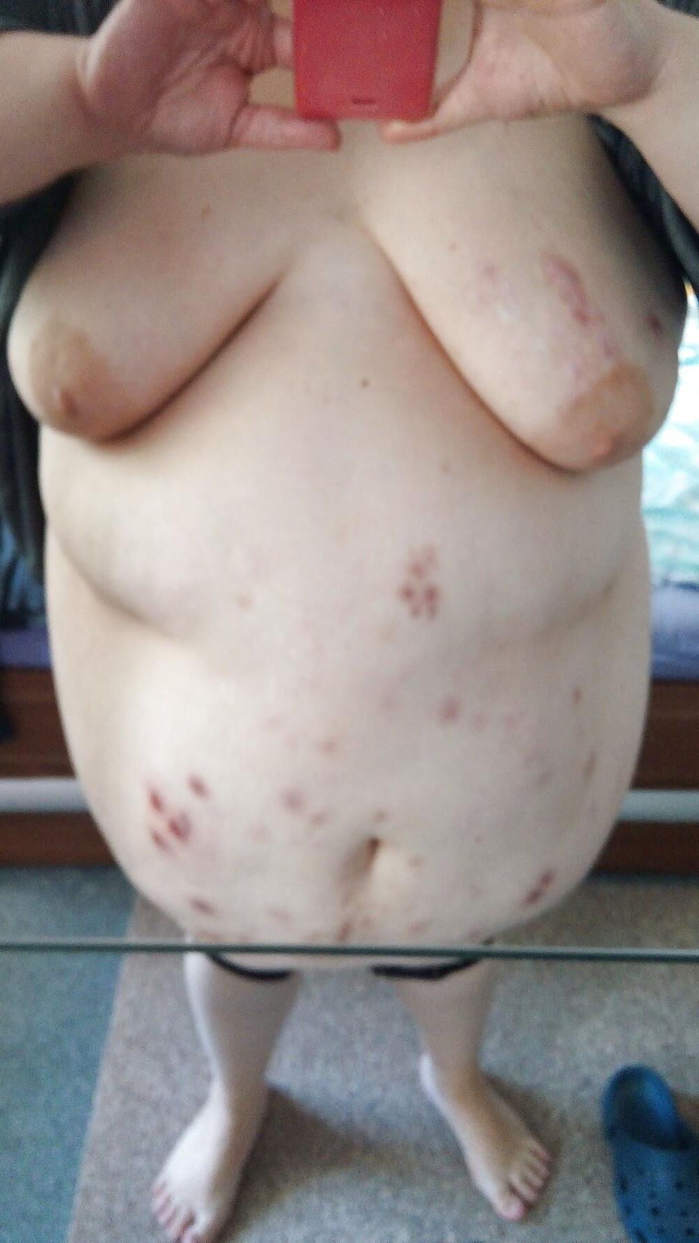 Acne, Sores, Discolored skin