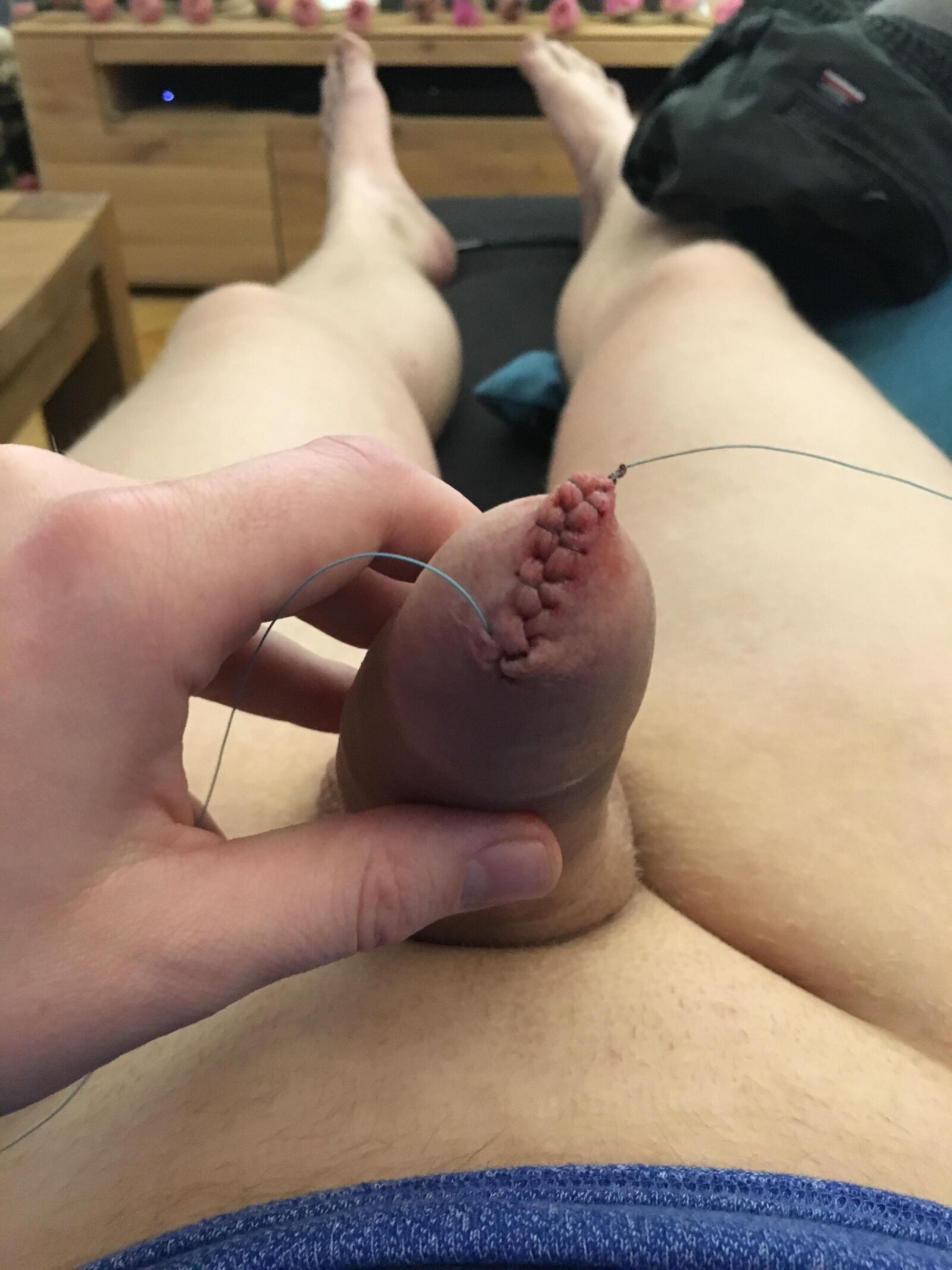 Foreskin games (sew foreskin)
