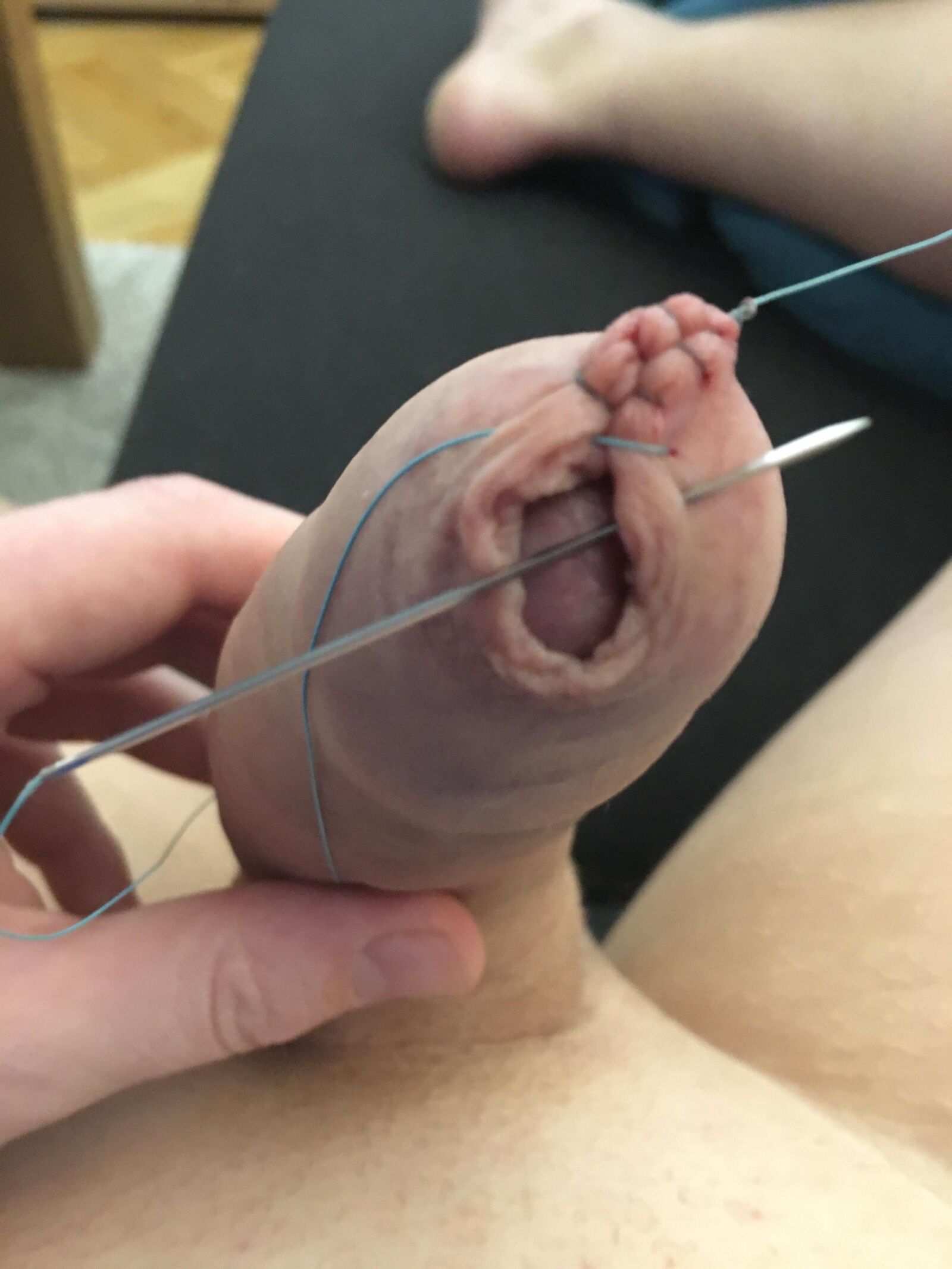 Foreskin games (sew foreskin)