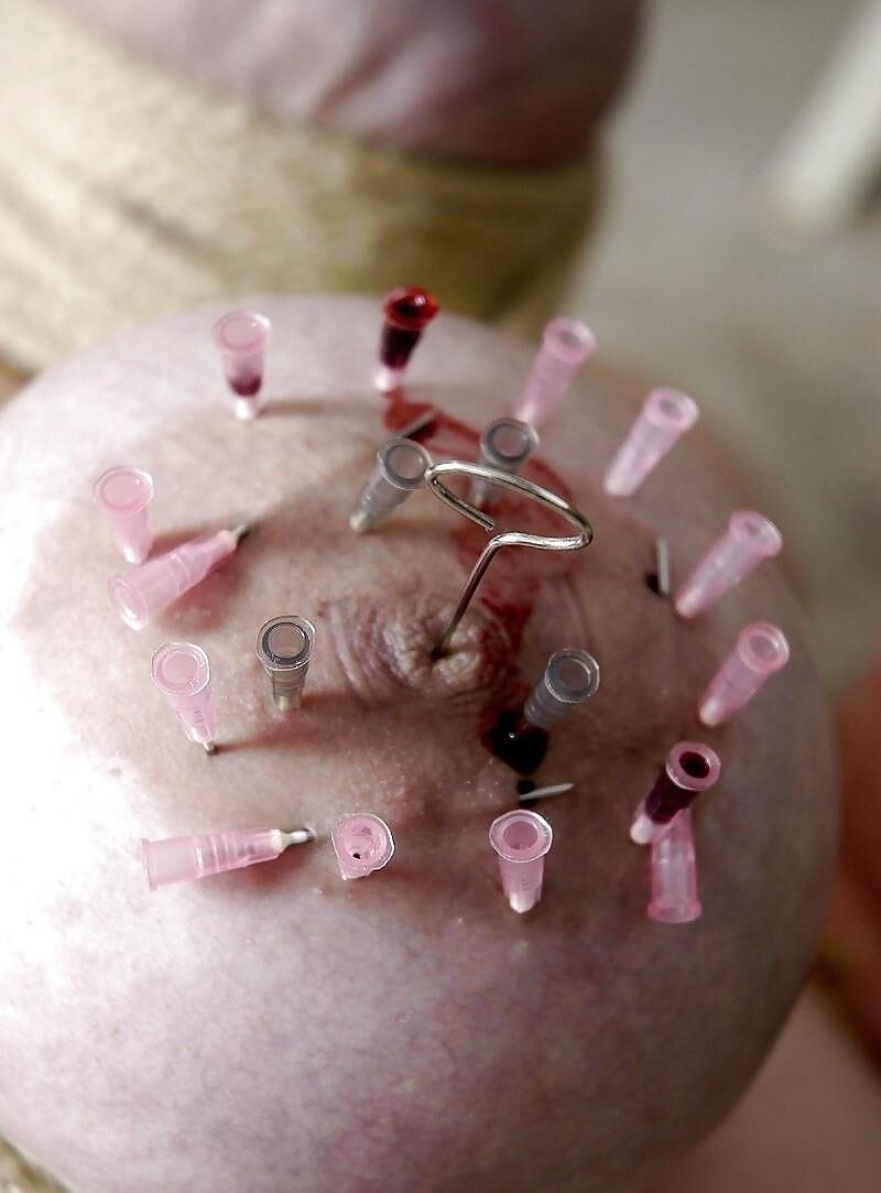 Jeweler's hard pics of breast with needles