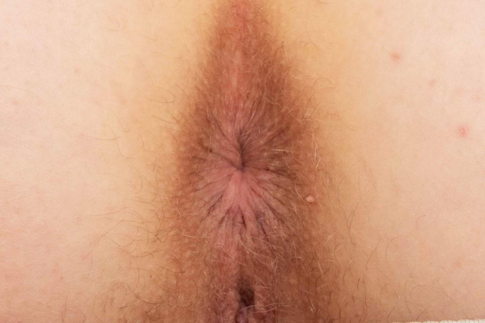 HD Female Asshole Closeups #