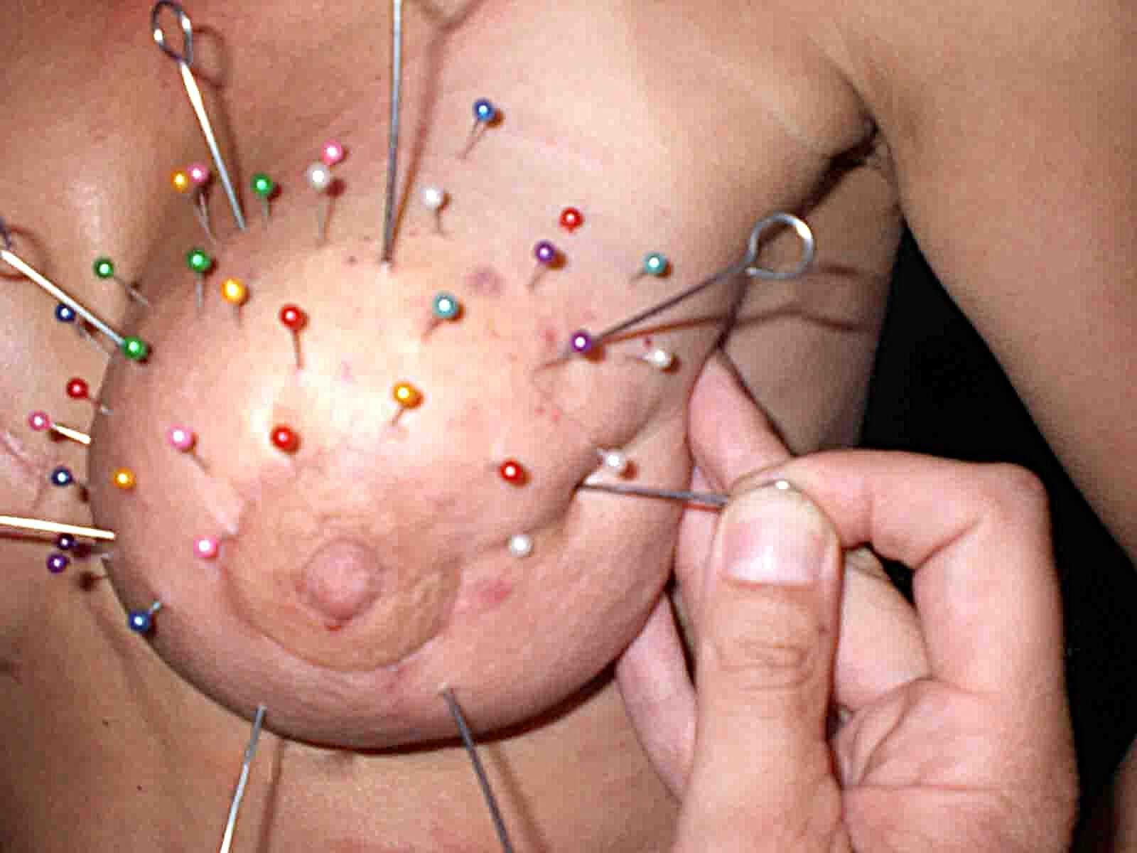 Jeweler's hard pics of breast with needles