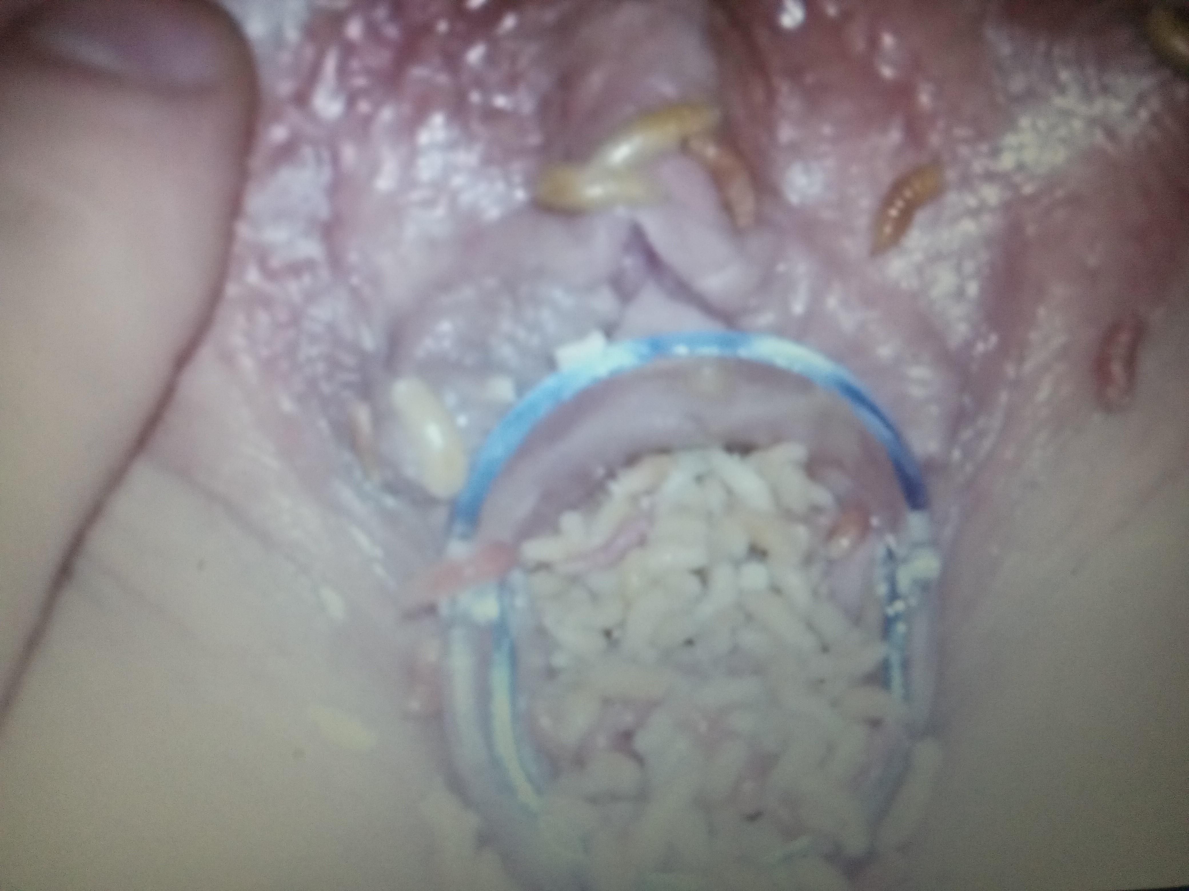 Speculum fun