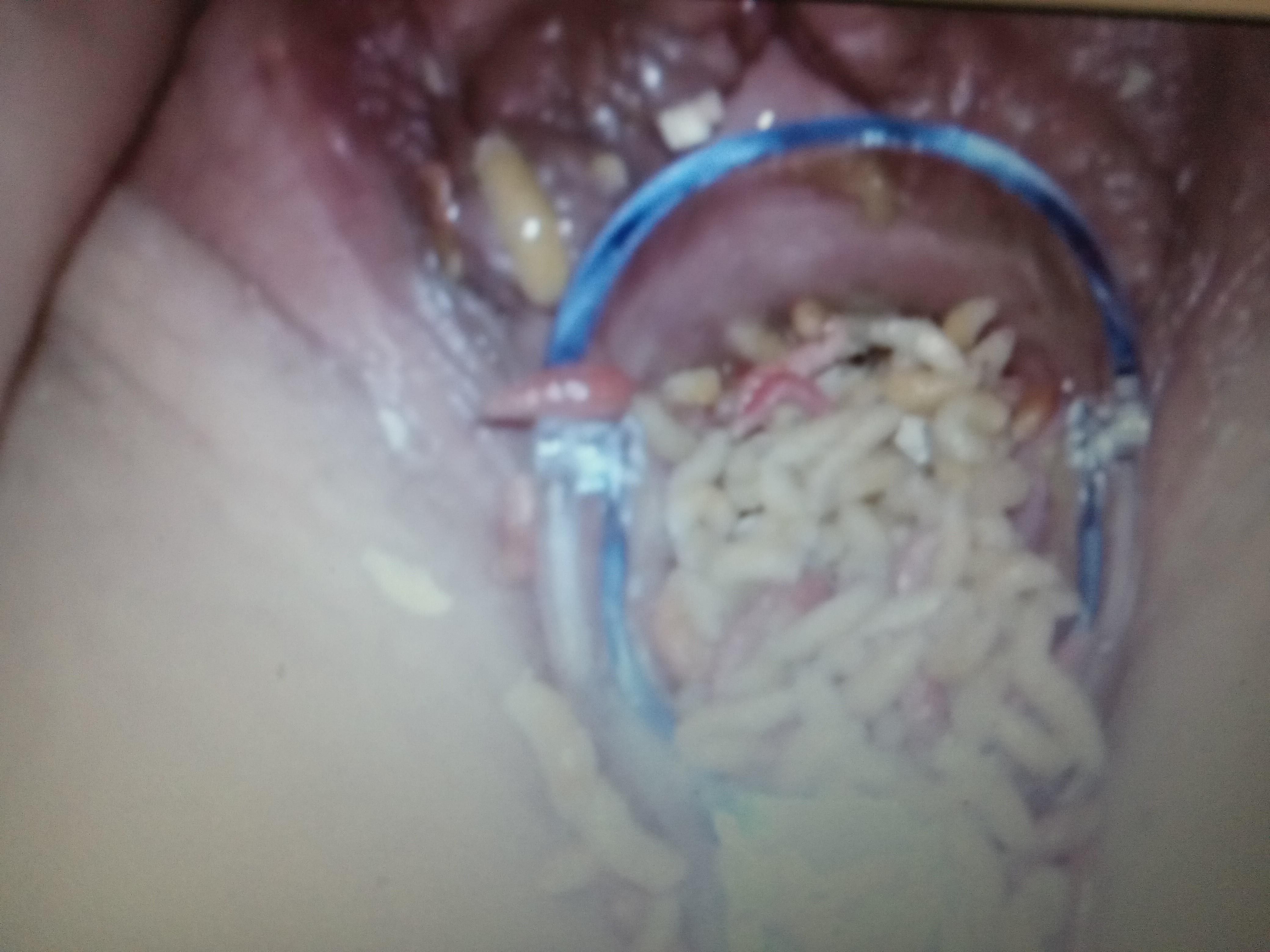 Speculum fun