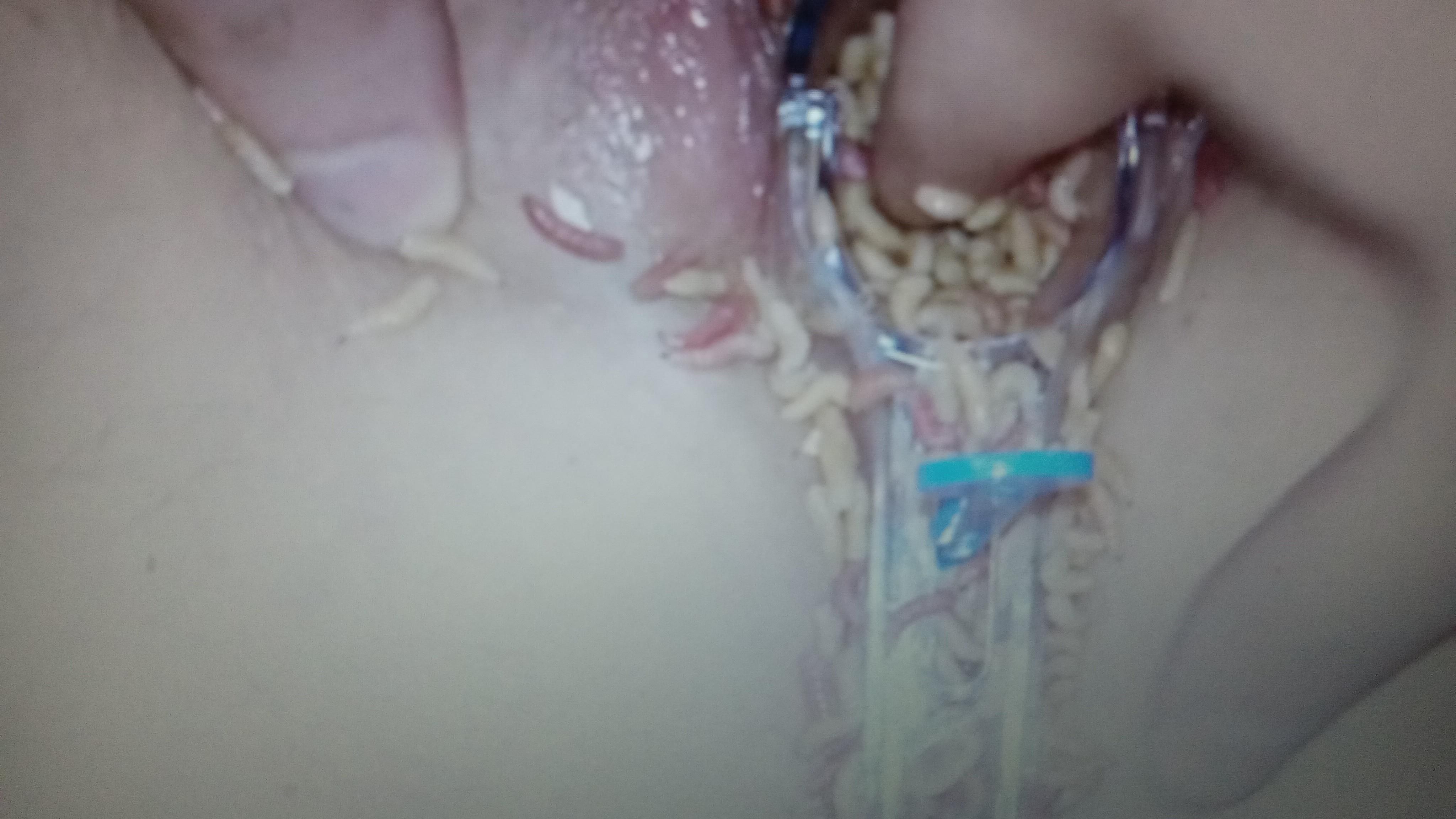 Speculum fun