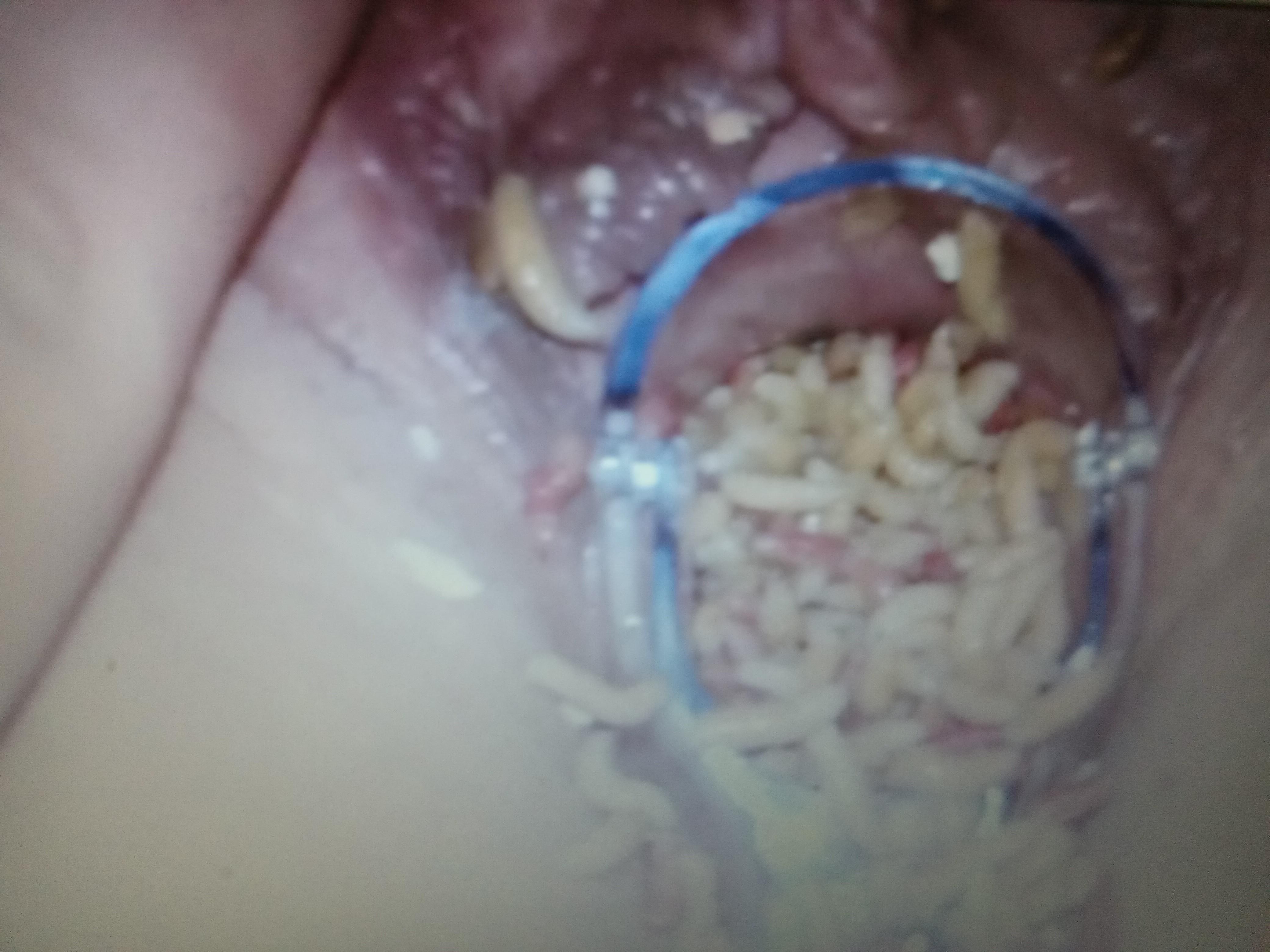 Speculum fun