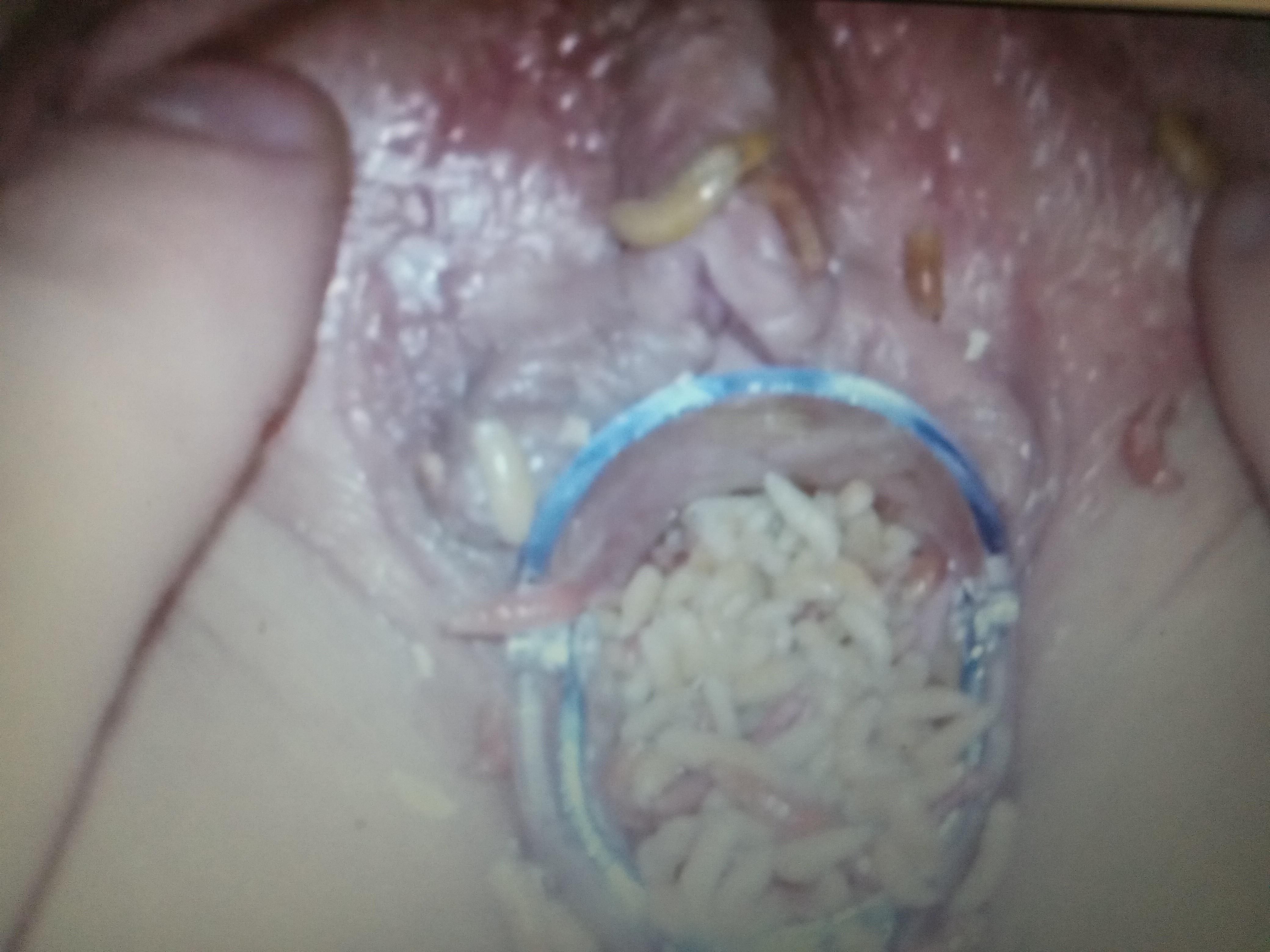 Speculum fun
