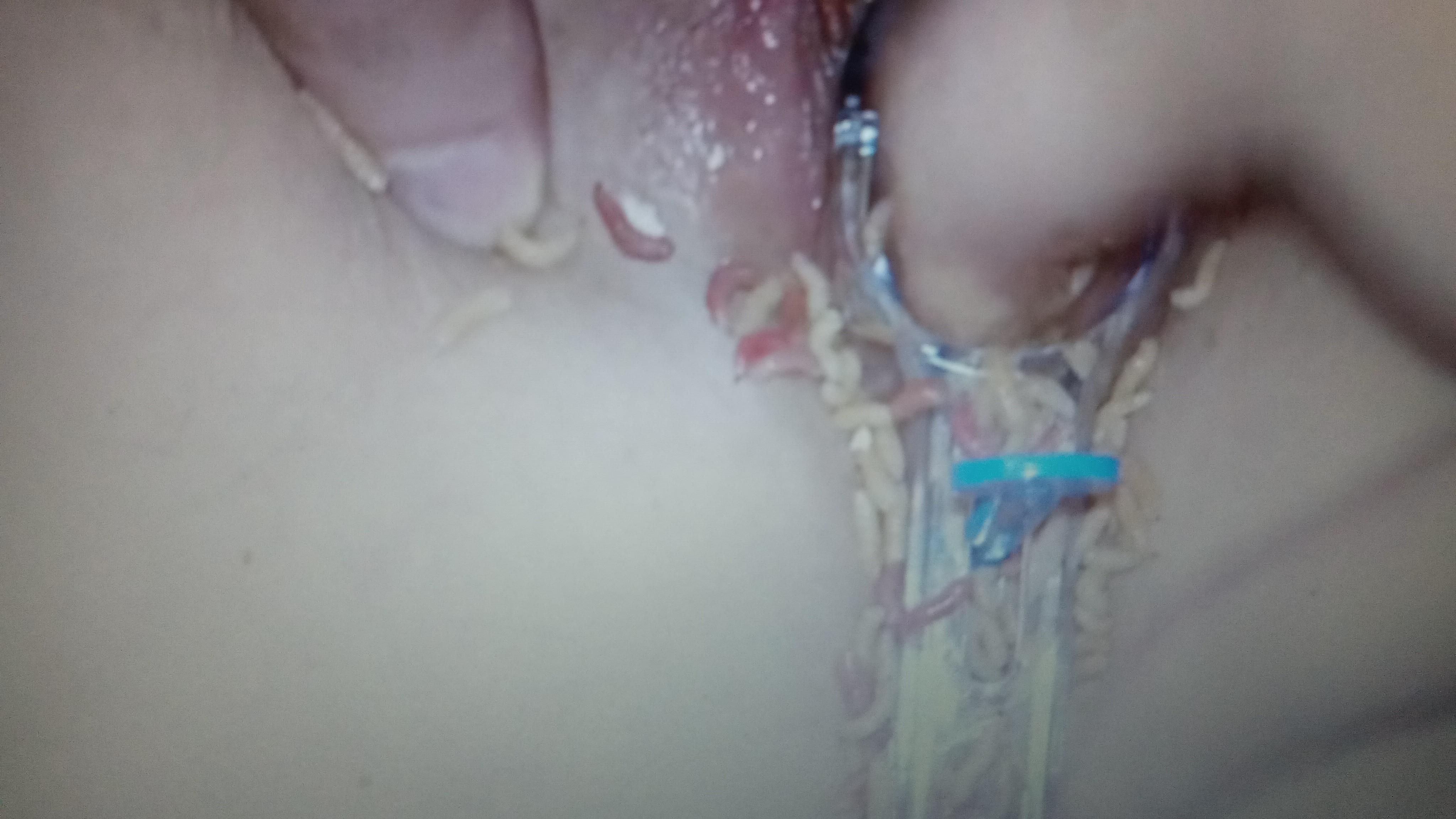 Speculum fun