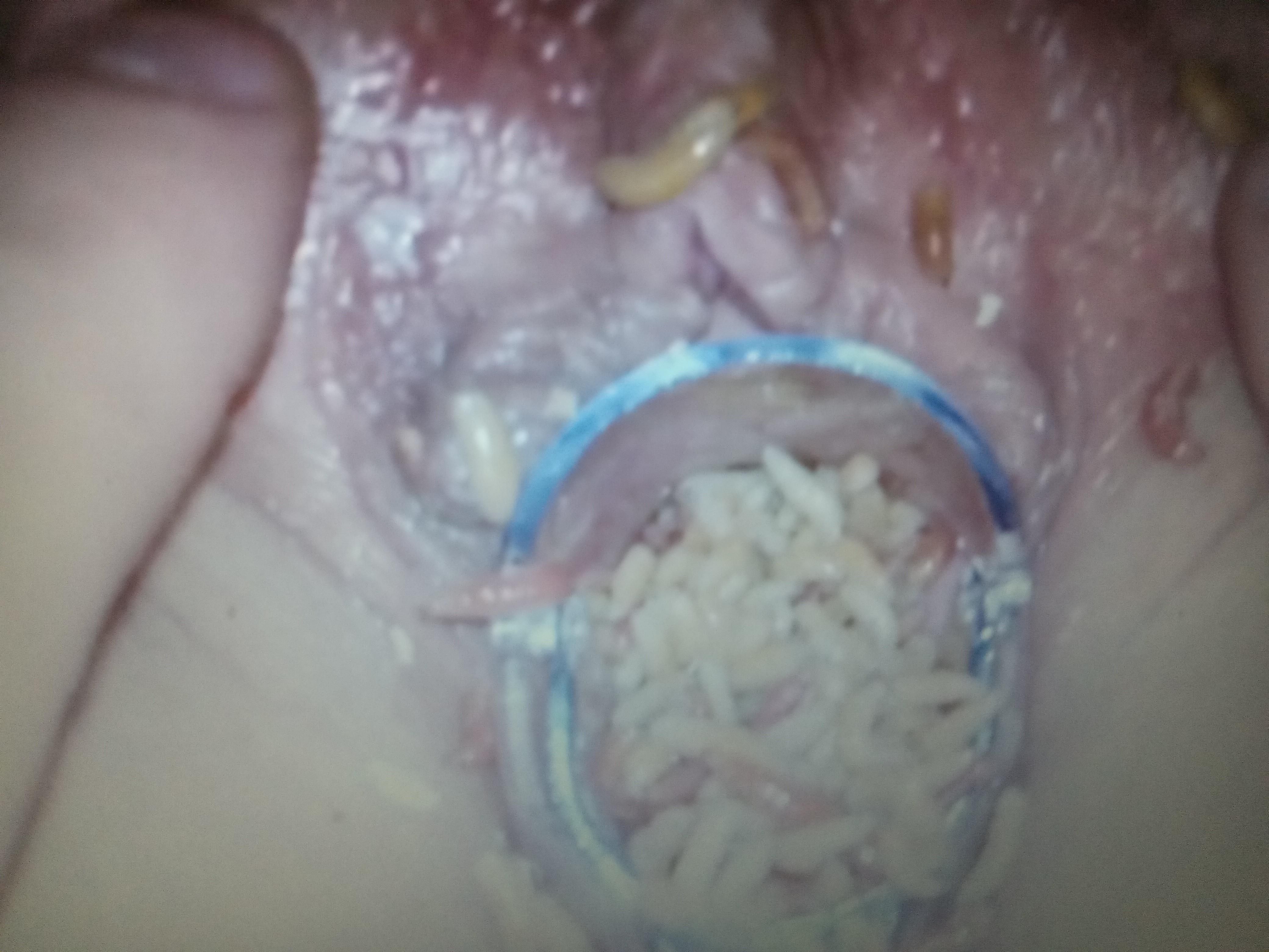 Speculum fun