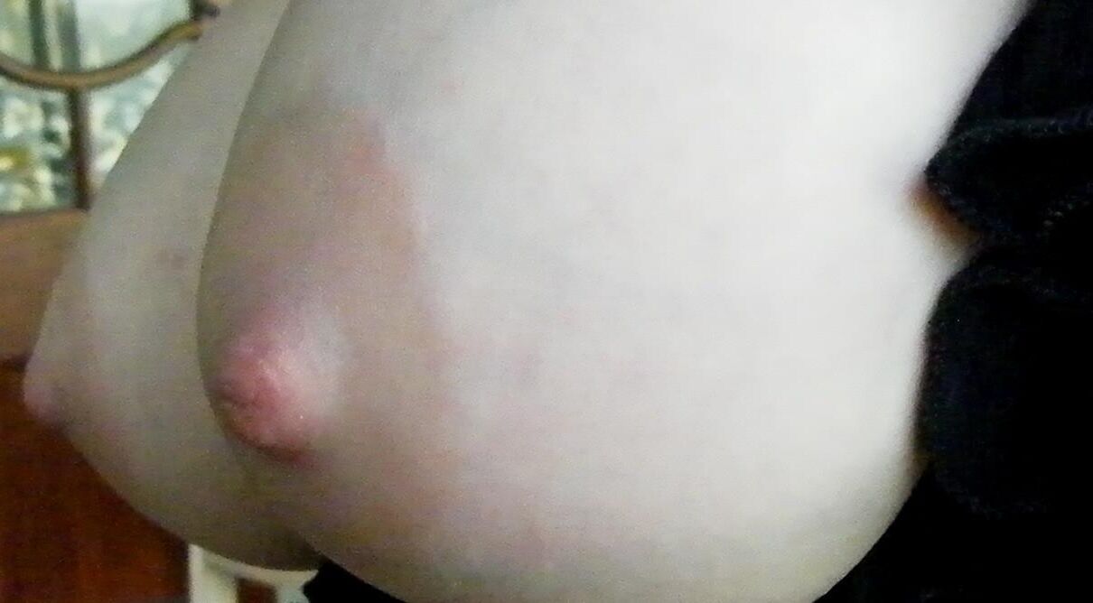 Nippleland.