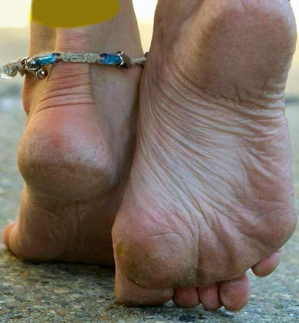 bare foot hard soles and heels close ups cheesy smell