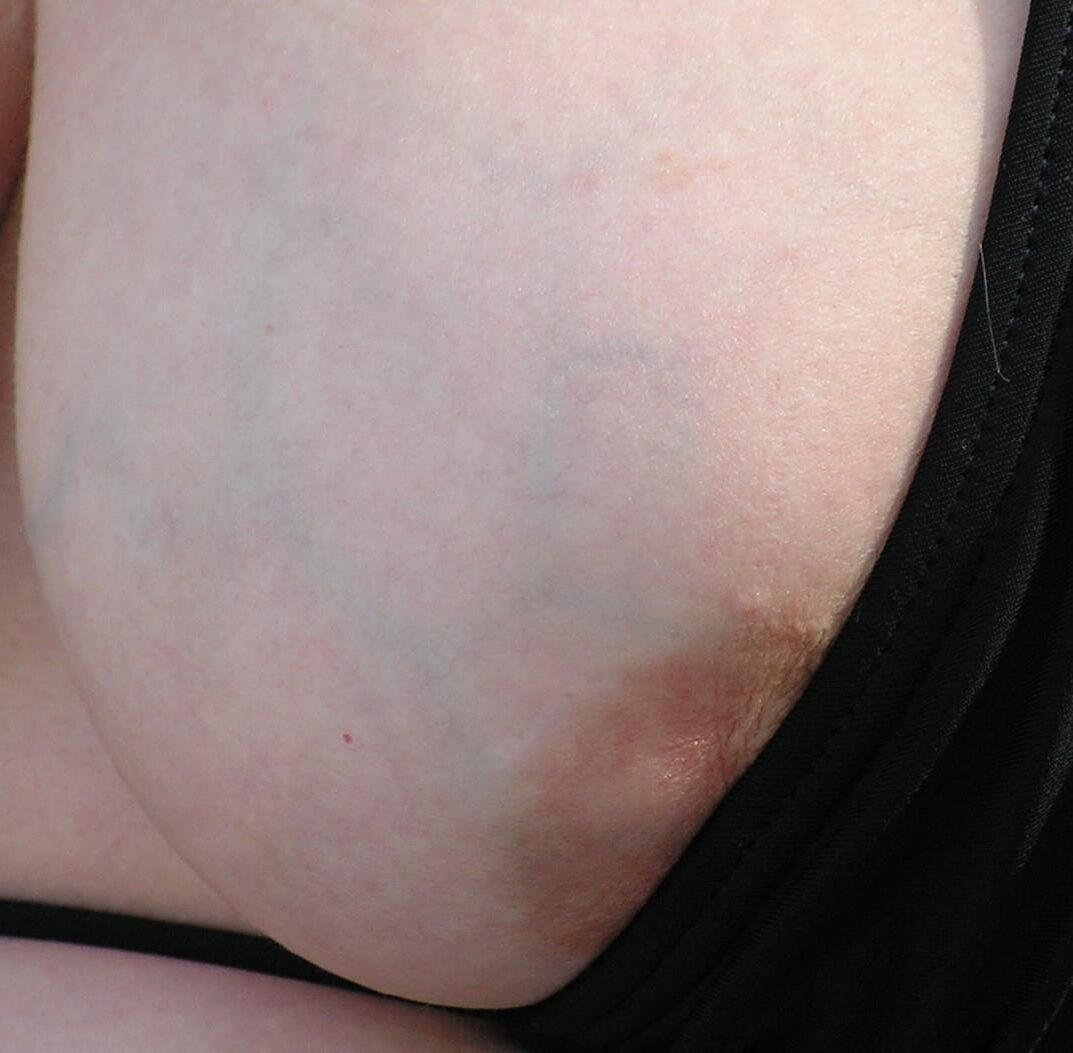 Nippleland.