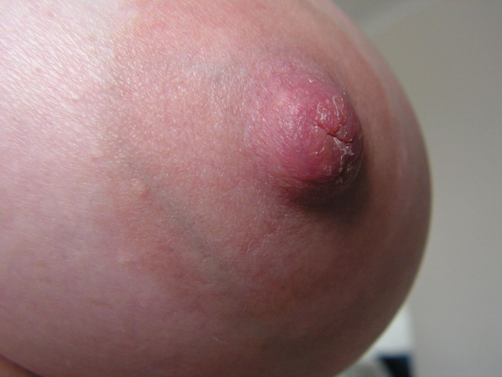 Nippleland.