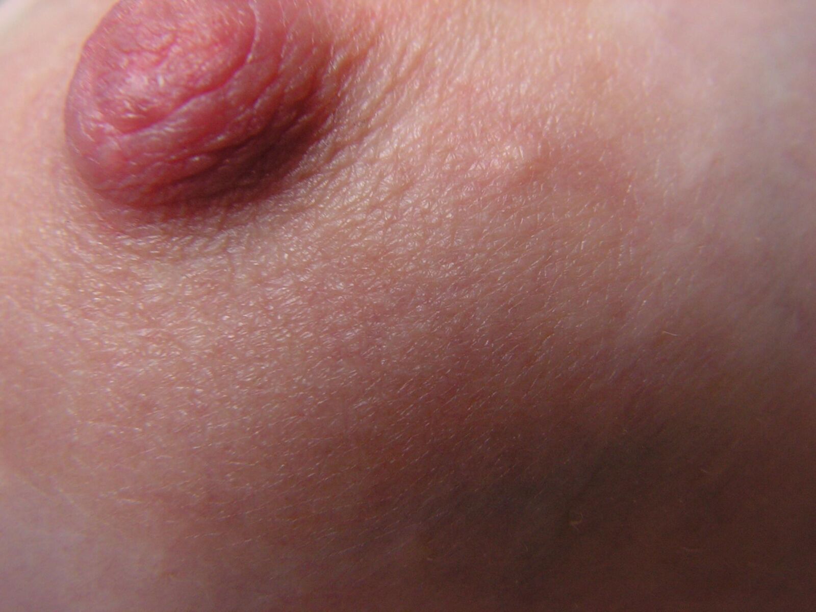 Nippleland.