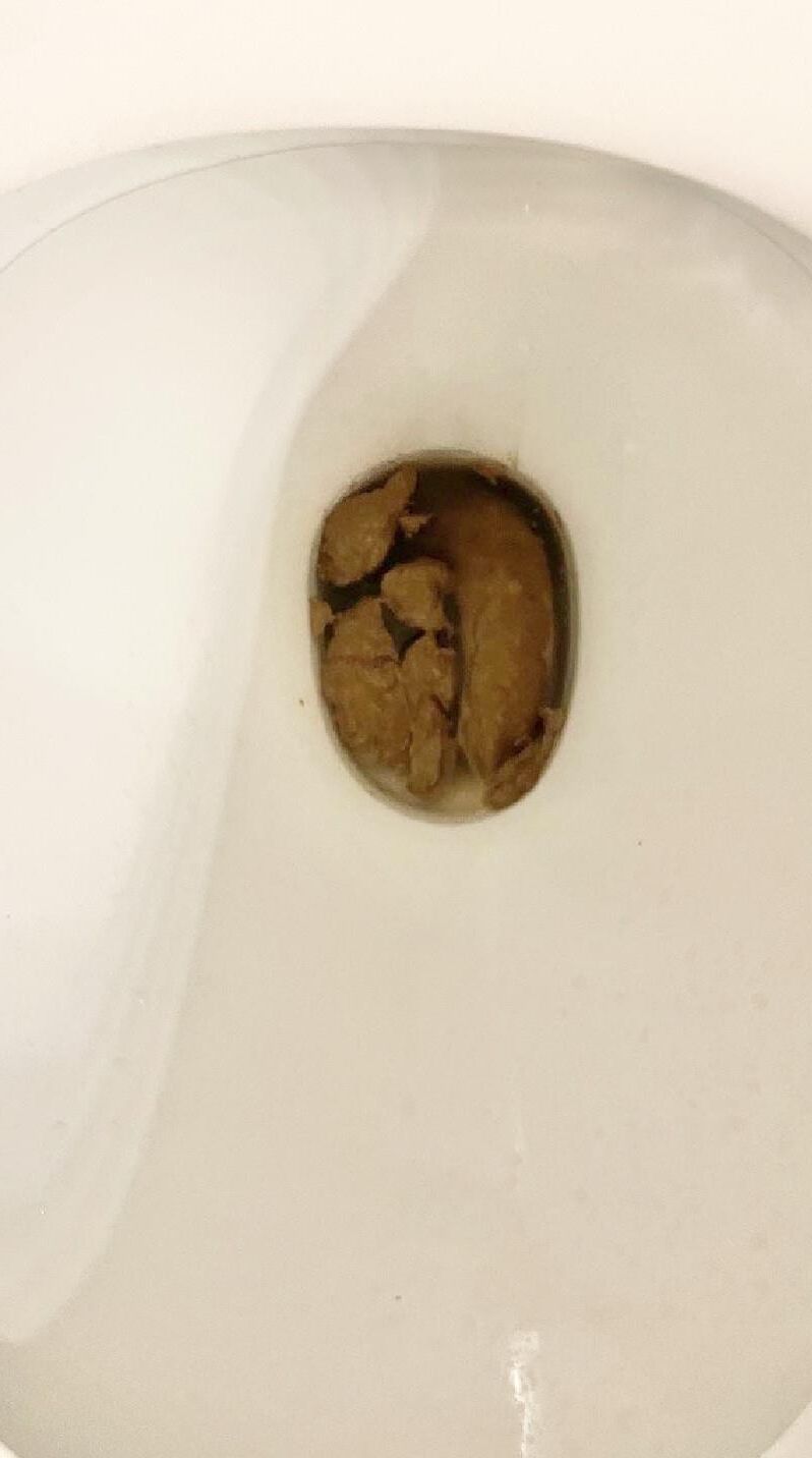PM
